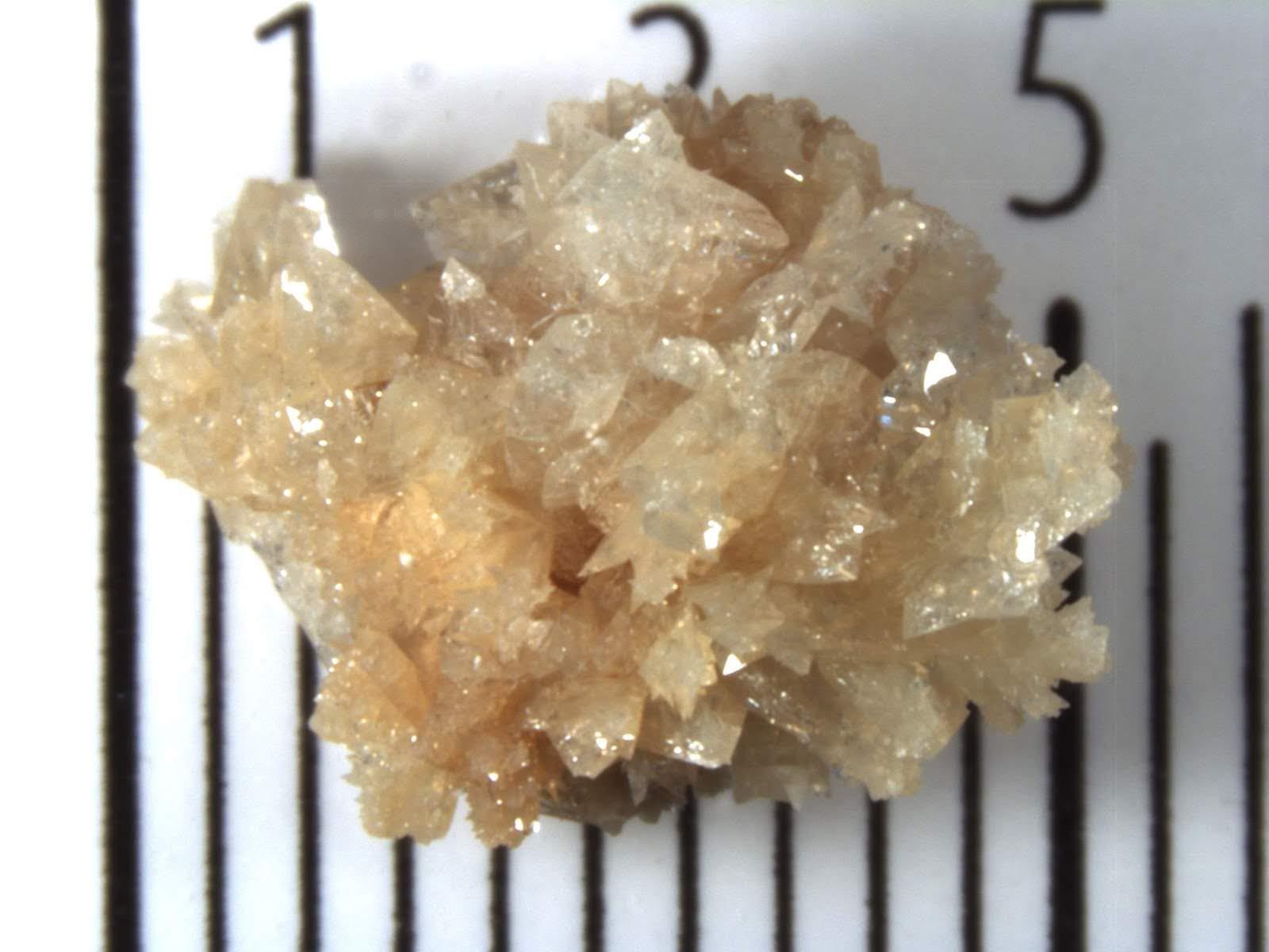 My kidney stone. r/microscopy