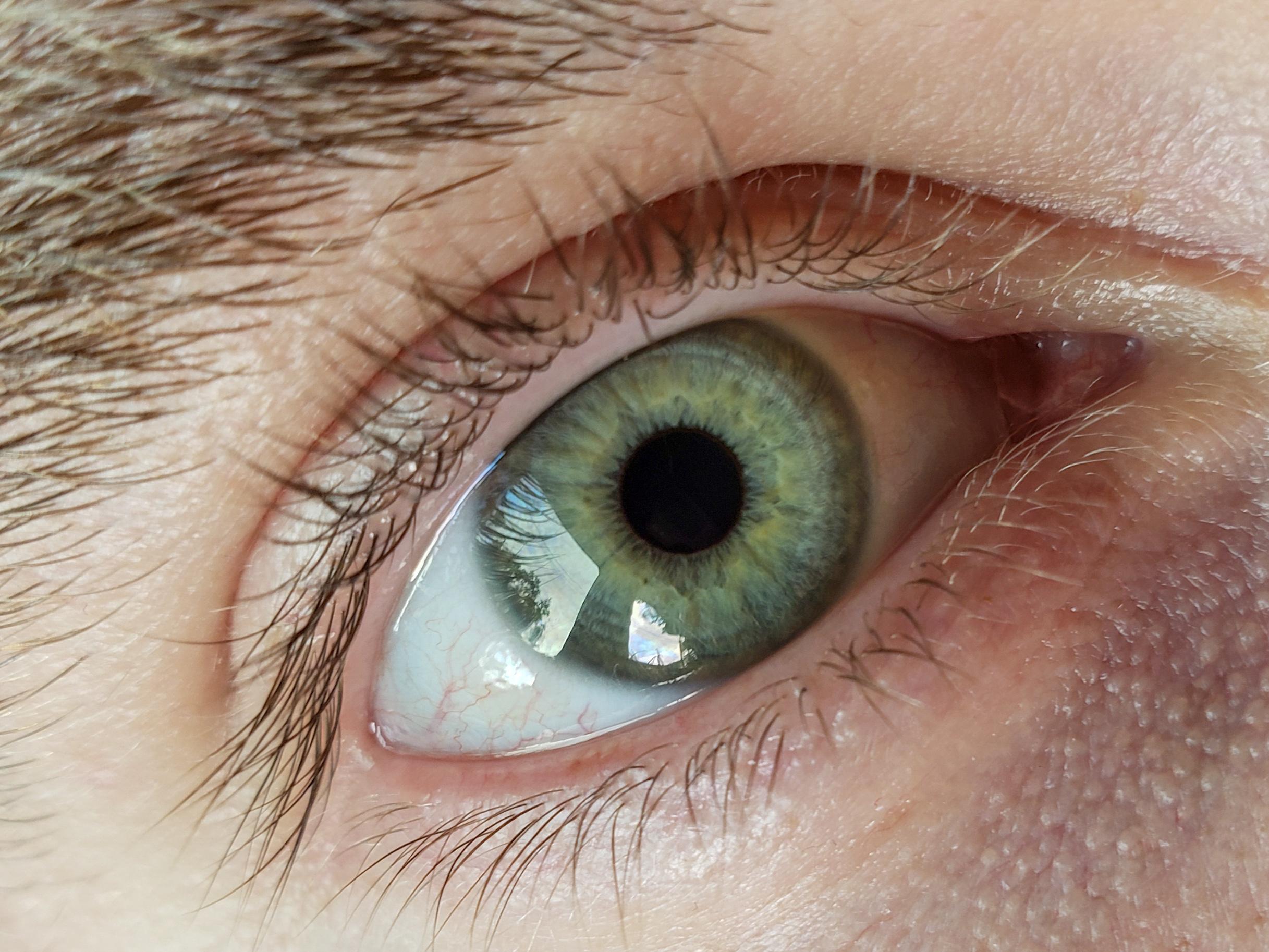 Greenish eyes with yellow r/eyes