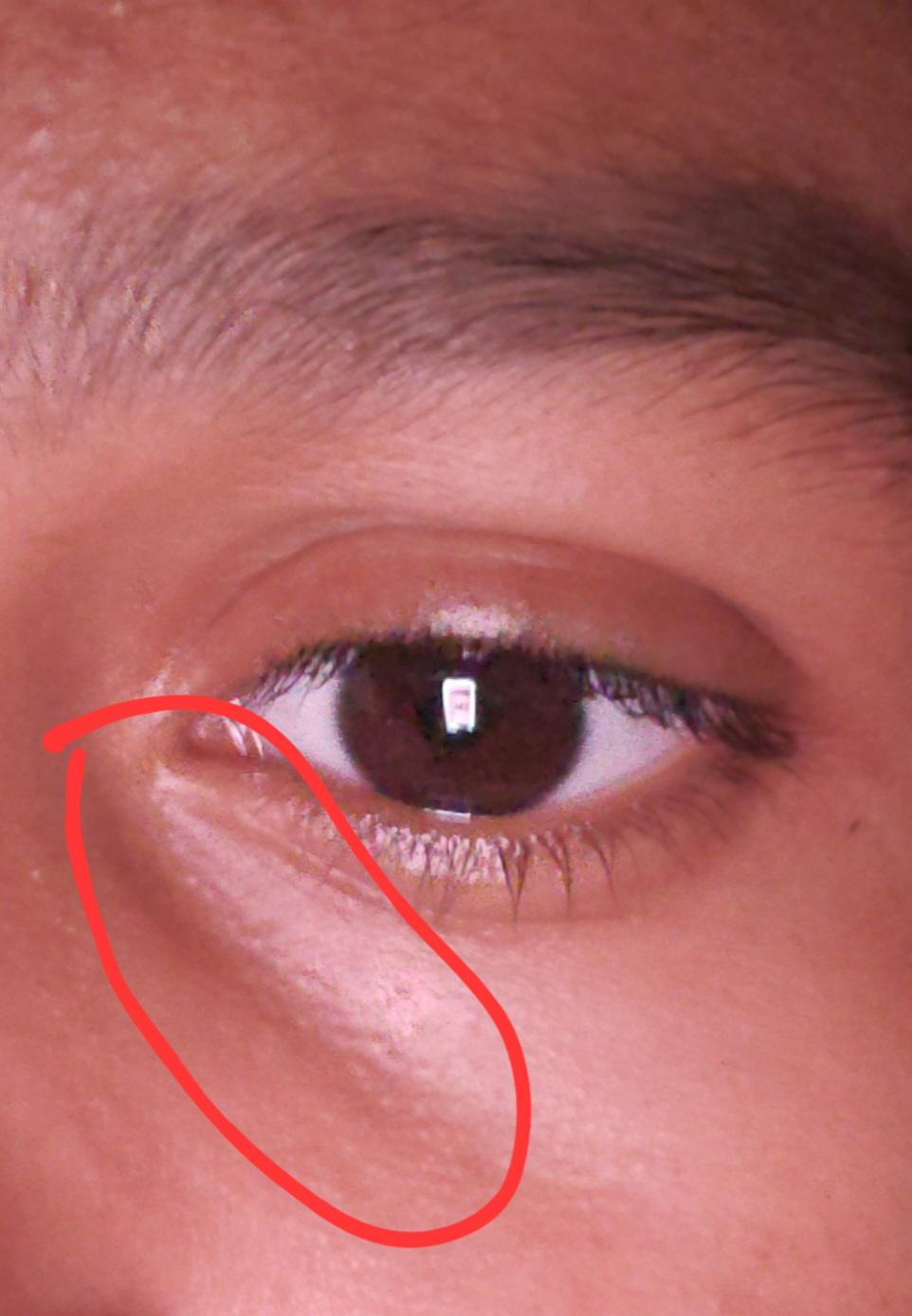 I'm really insecure of taking off my glasses because of the marks is