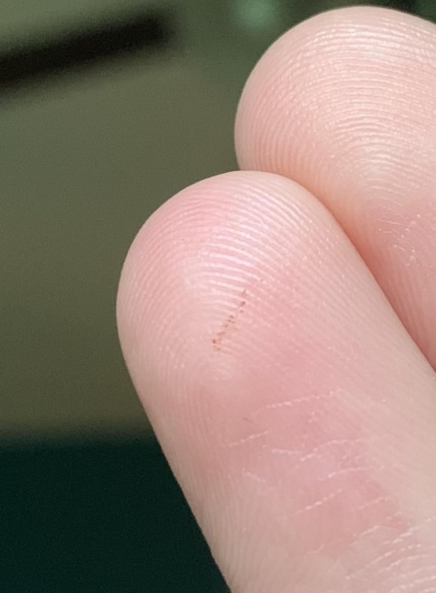 Line on finger pad?? I noticed this pigmented line on one of my fingers