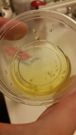 Been Having Tissue/Particles In My Urine. 22 Year Old Female Only Things I Take Are Multivitamins, Probiotics. Ive Been Having These Floating Clumps/ Particles In My Urine For Quite Awhile. Doctors Have Found