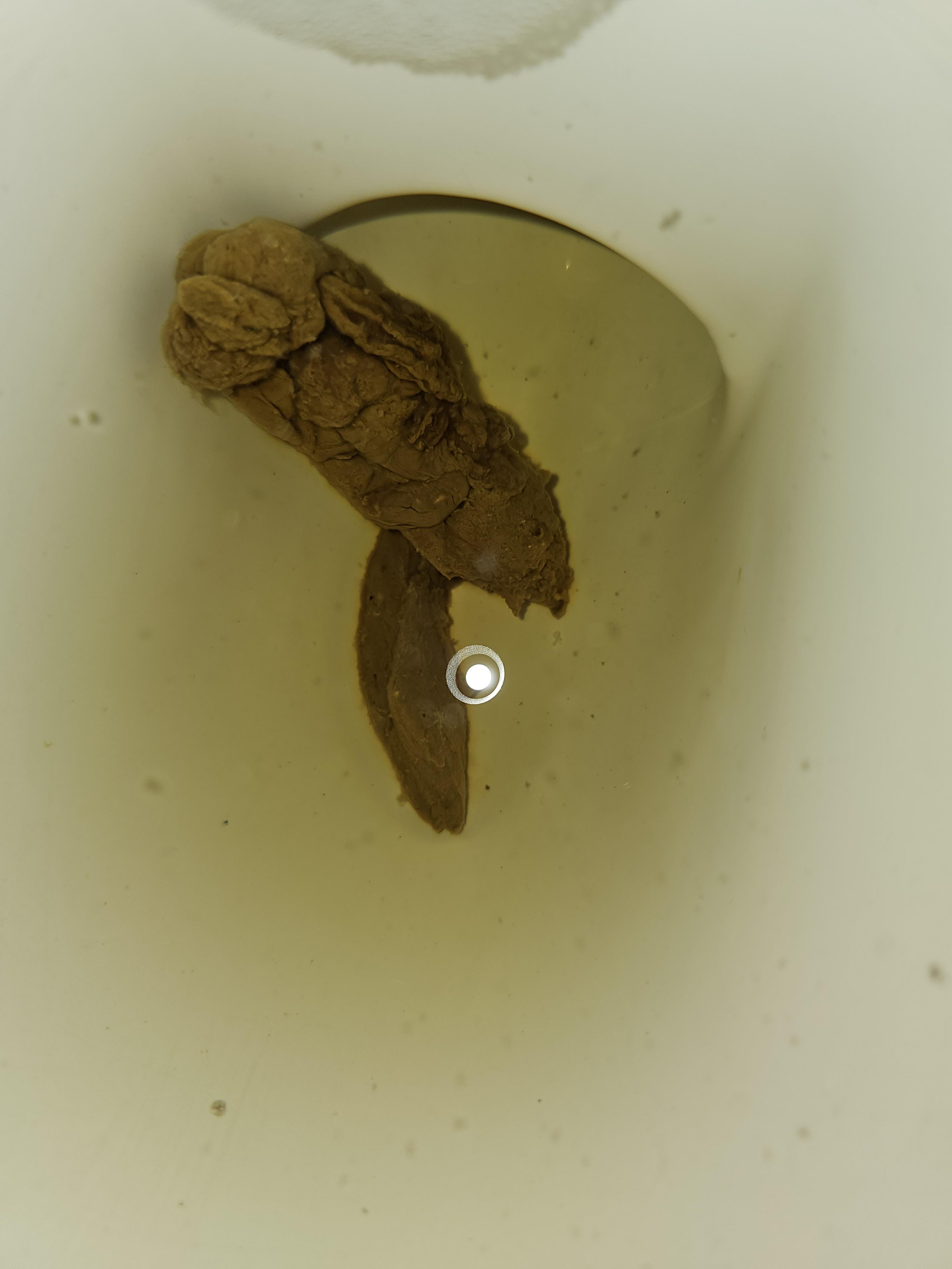 Deformed stools r/poop