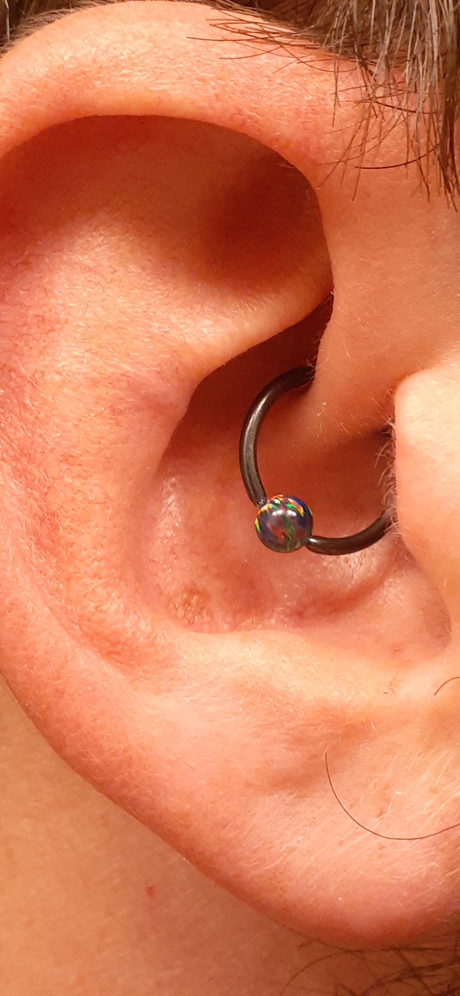 After years of migraines and daily ibuprofen intake, I decided to get a