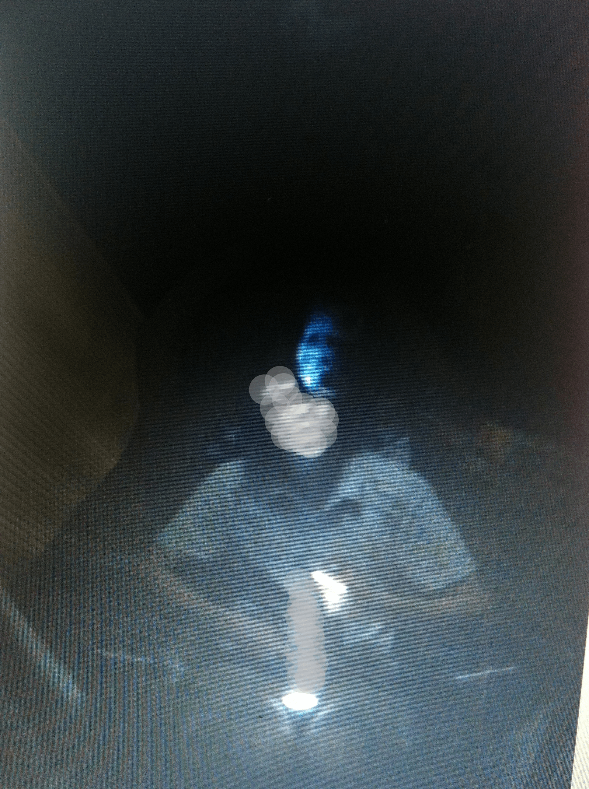 ***Disclaimer I do not own therefore I did my best blurring