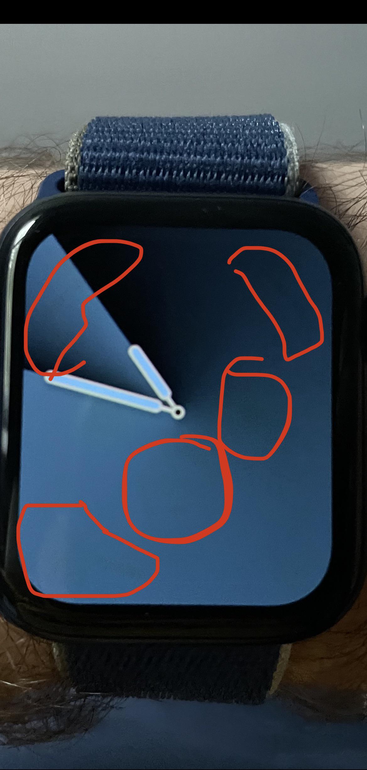 Screen burn in on Series 6 after a year. Anyone else notice this? It’s