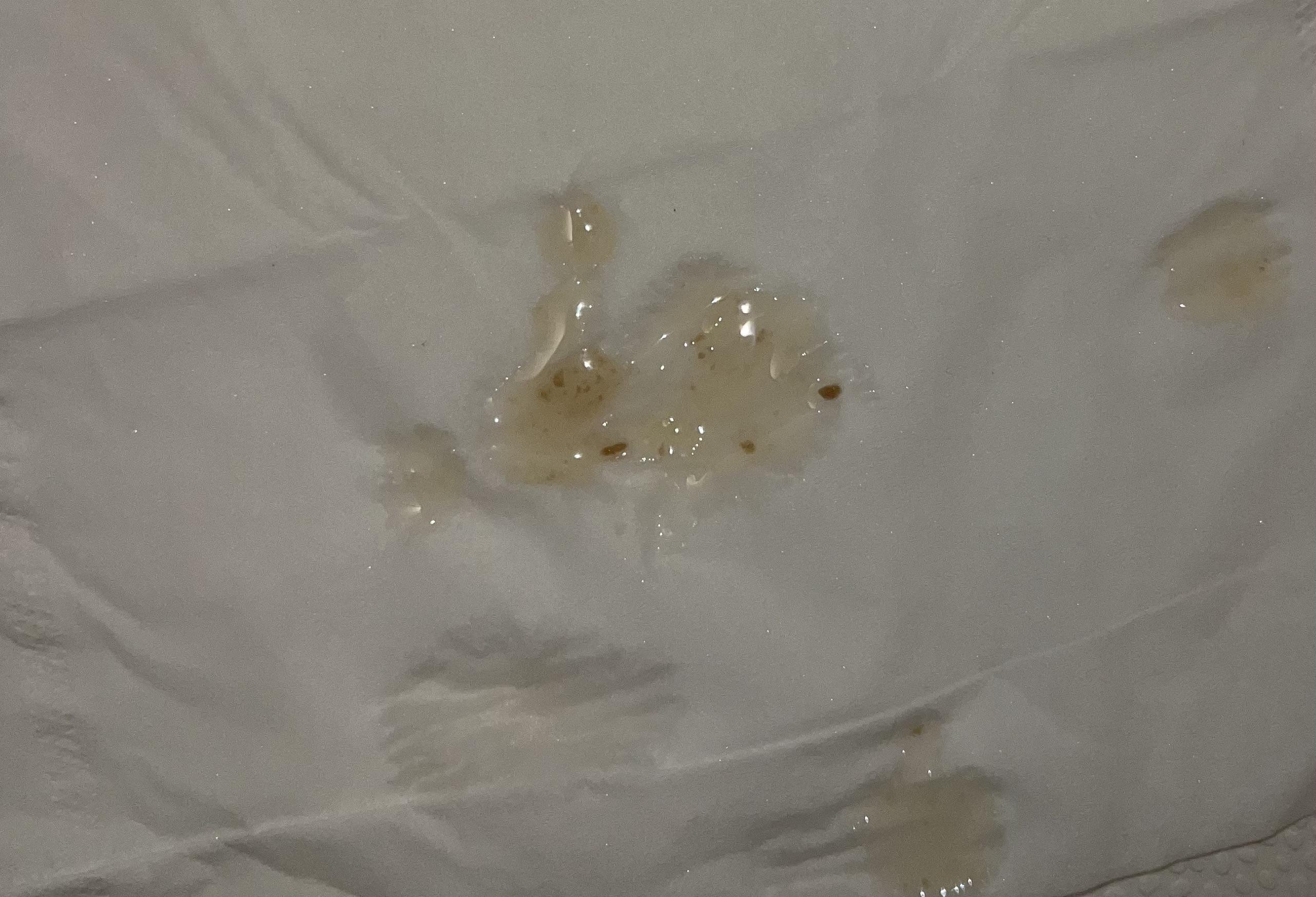 Brown Chunks in Semen r/medical_advice