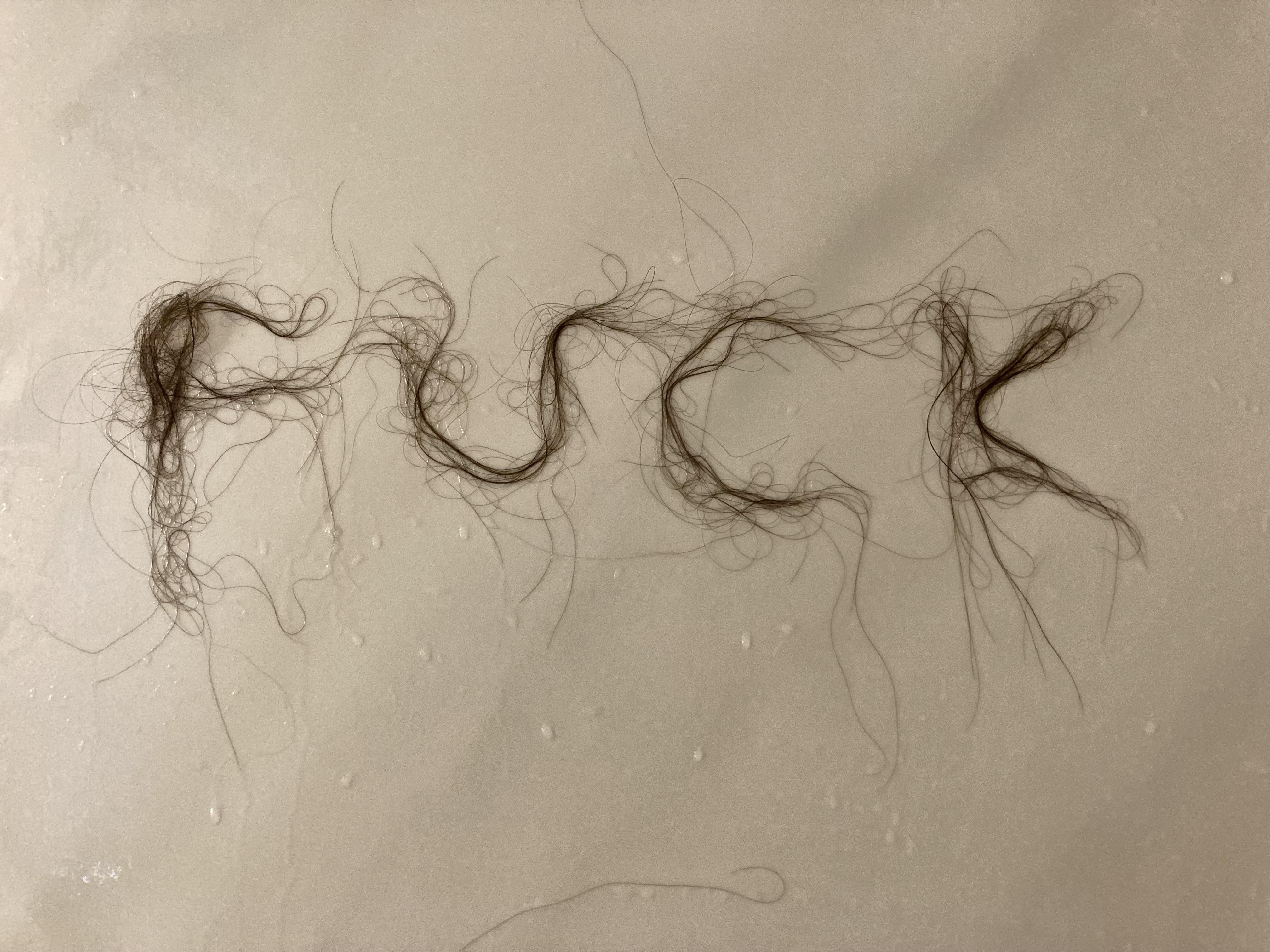 Postpartum hair loss r/beyondthebump