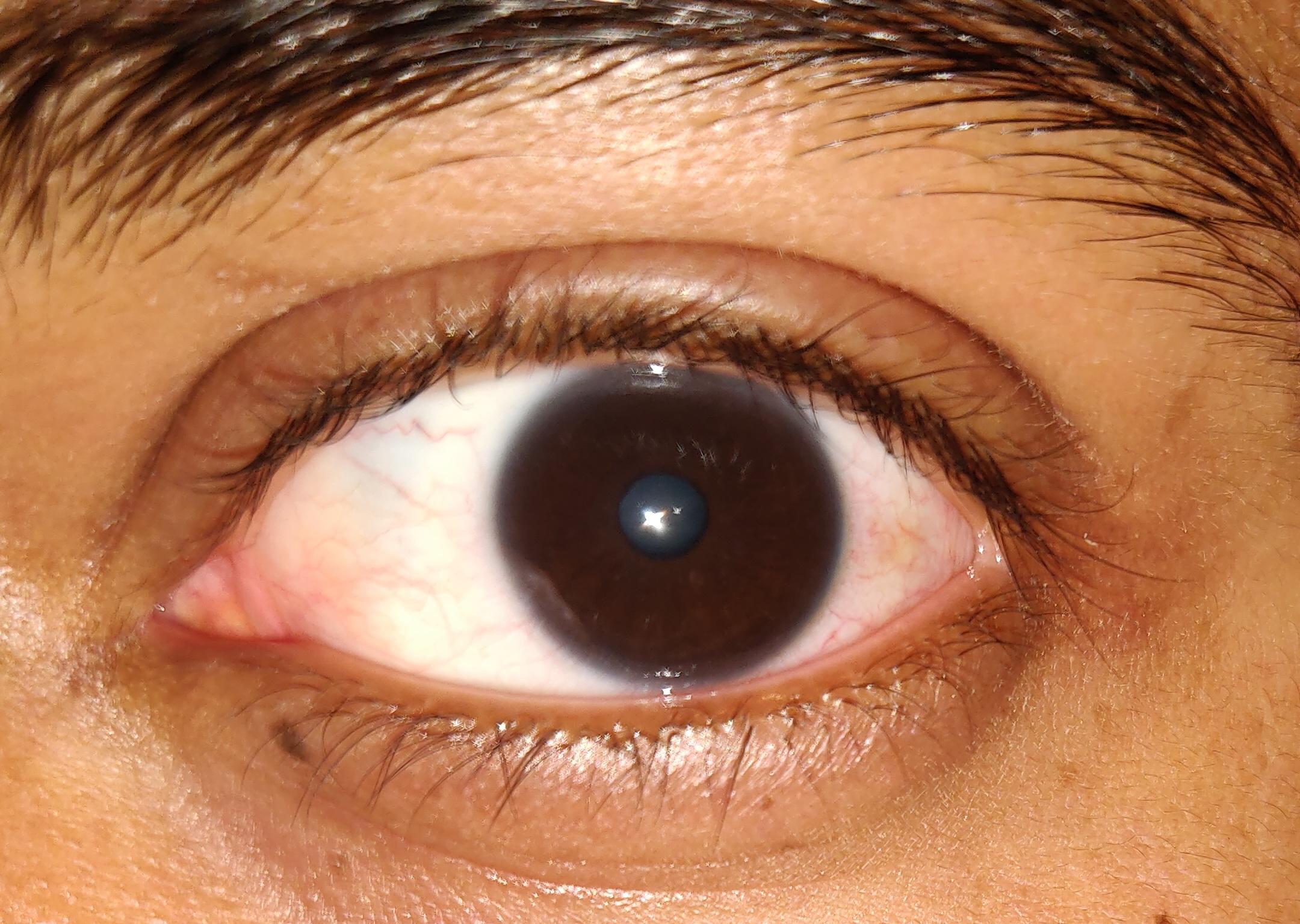 my dark brown eyes r/eyes