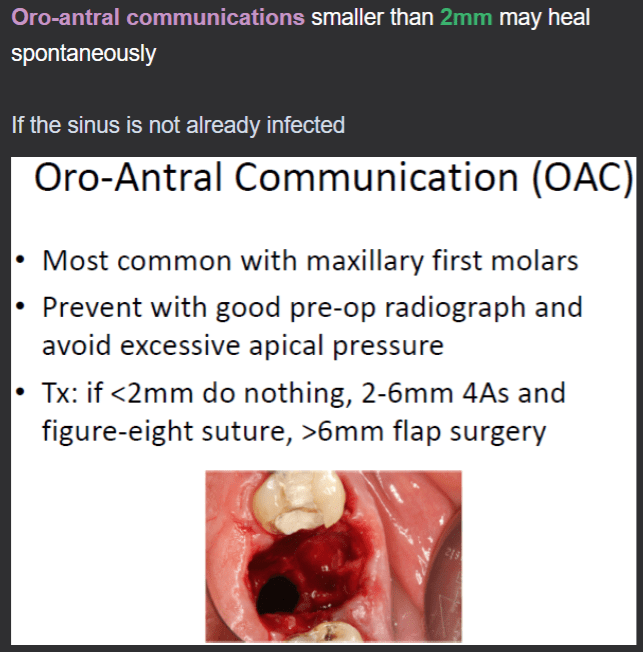 Netter Head and Neck Flashcard Anki deck Updated! dentalschoolanki
