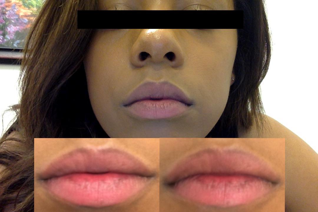 [Routine Help] 🆘 ️can someone please help with tips and