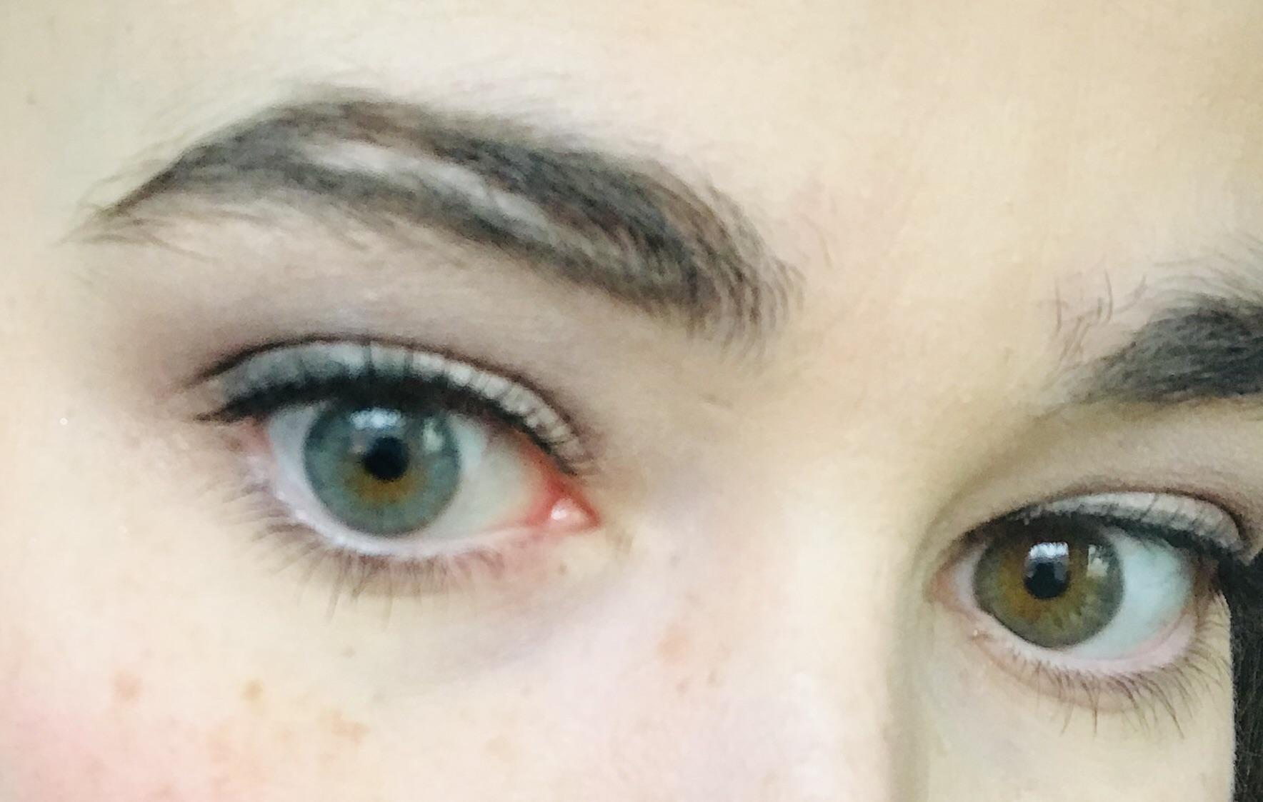 Recently stopped filling in my eyebrow scar from when I face planted