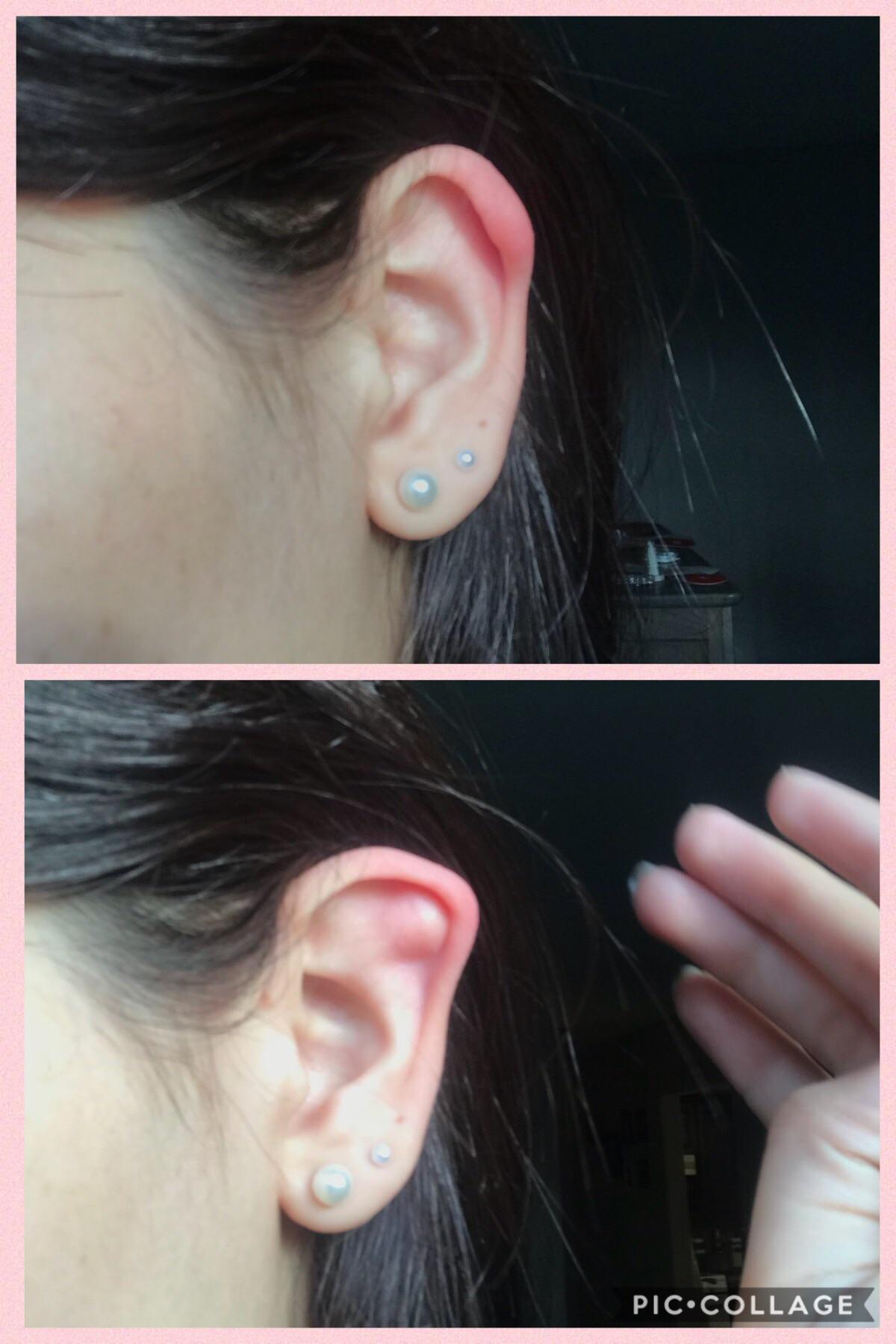 I have floppy cartilage in one of my ears, and can flip the cartilage