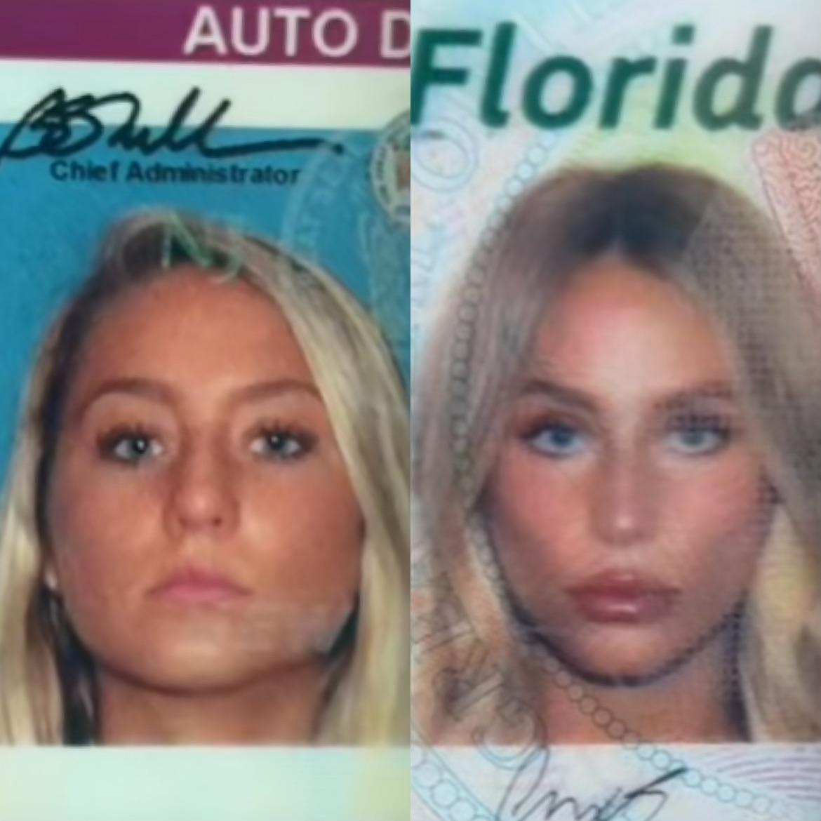 Alix Earle transformation I always thought she only had a boob job but