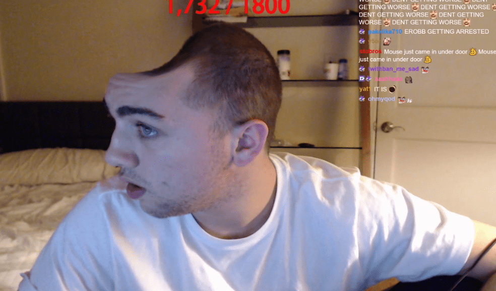 Fundraiser thread for mizkif's dent transplant (unedited image