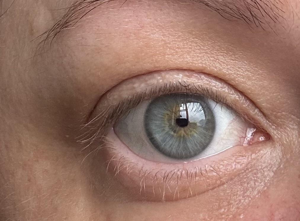 Are my eyes blue? r/eyes