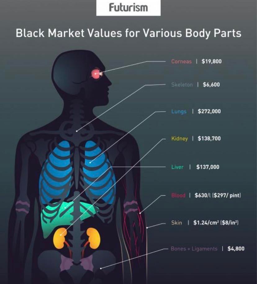 Black market prices for body parts! r/Damnthatsinteresting