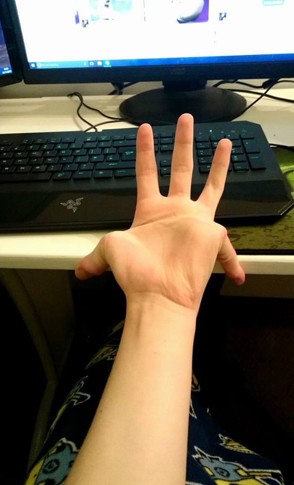 My Hypermobile Fingers. r/WTF