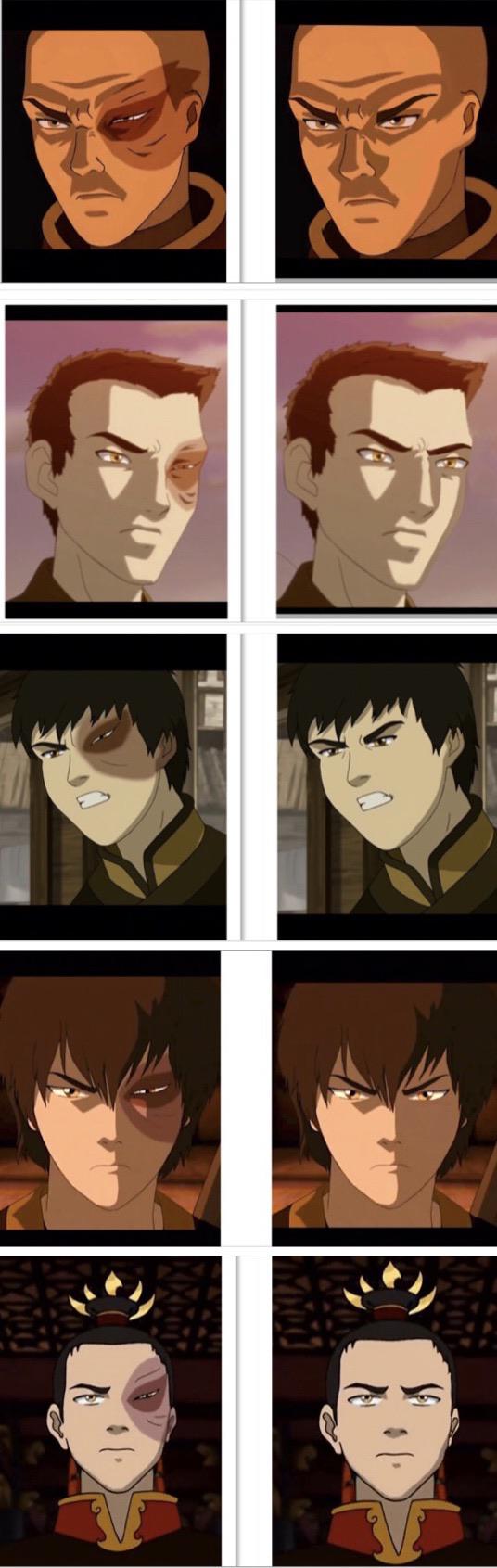 Zuko With And W/o The Iconic Scar R/TheLastAirbender, 45 OFF