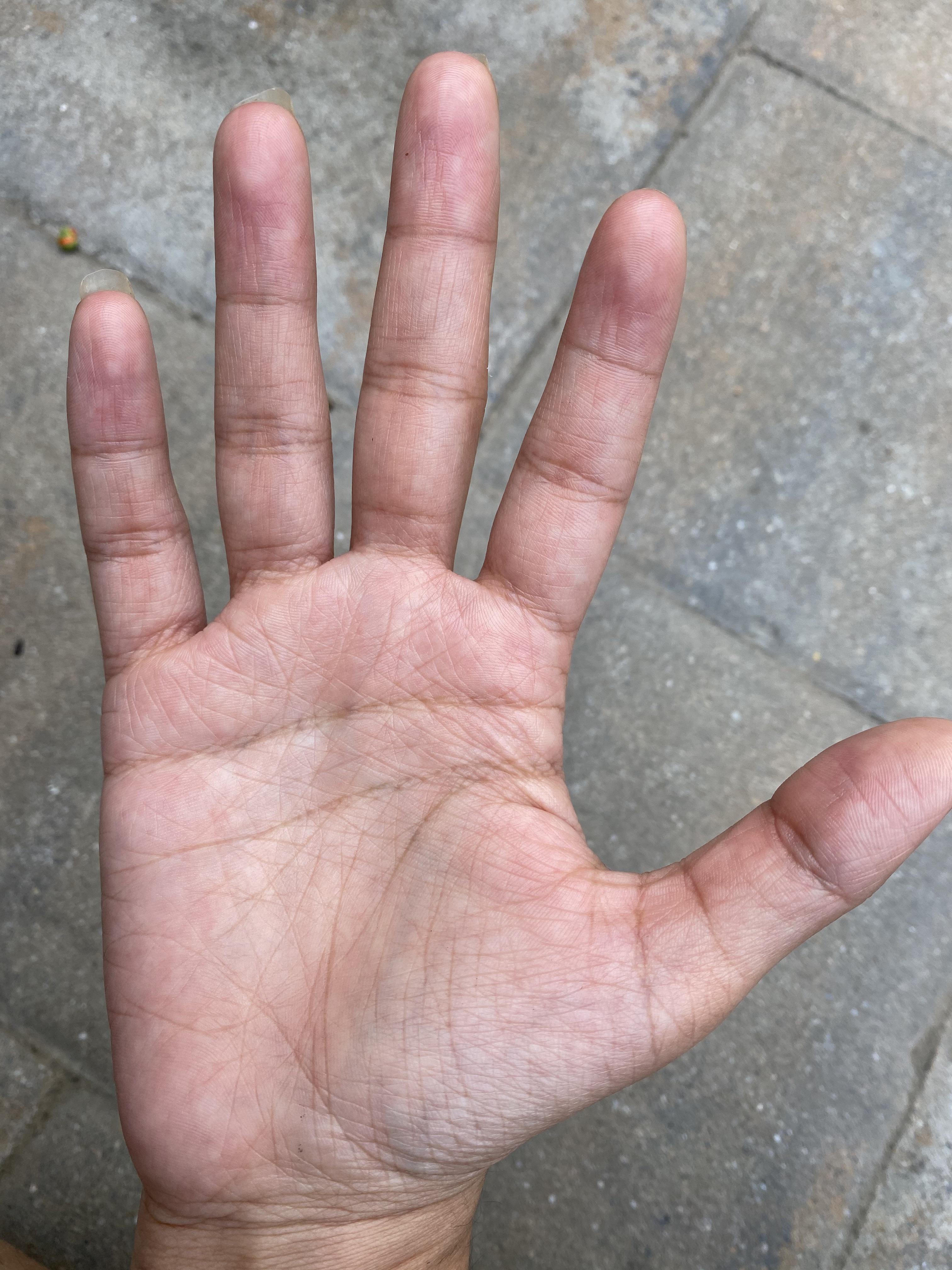 Anyone want to give my hand a go? I never saw anyone with a line that