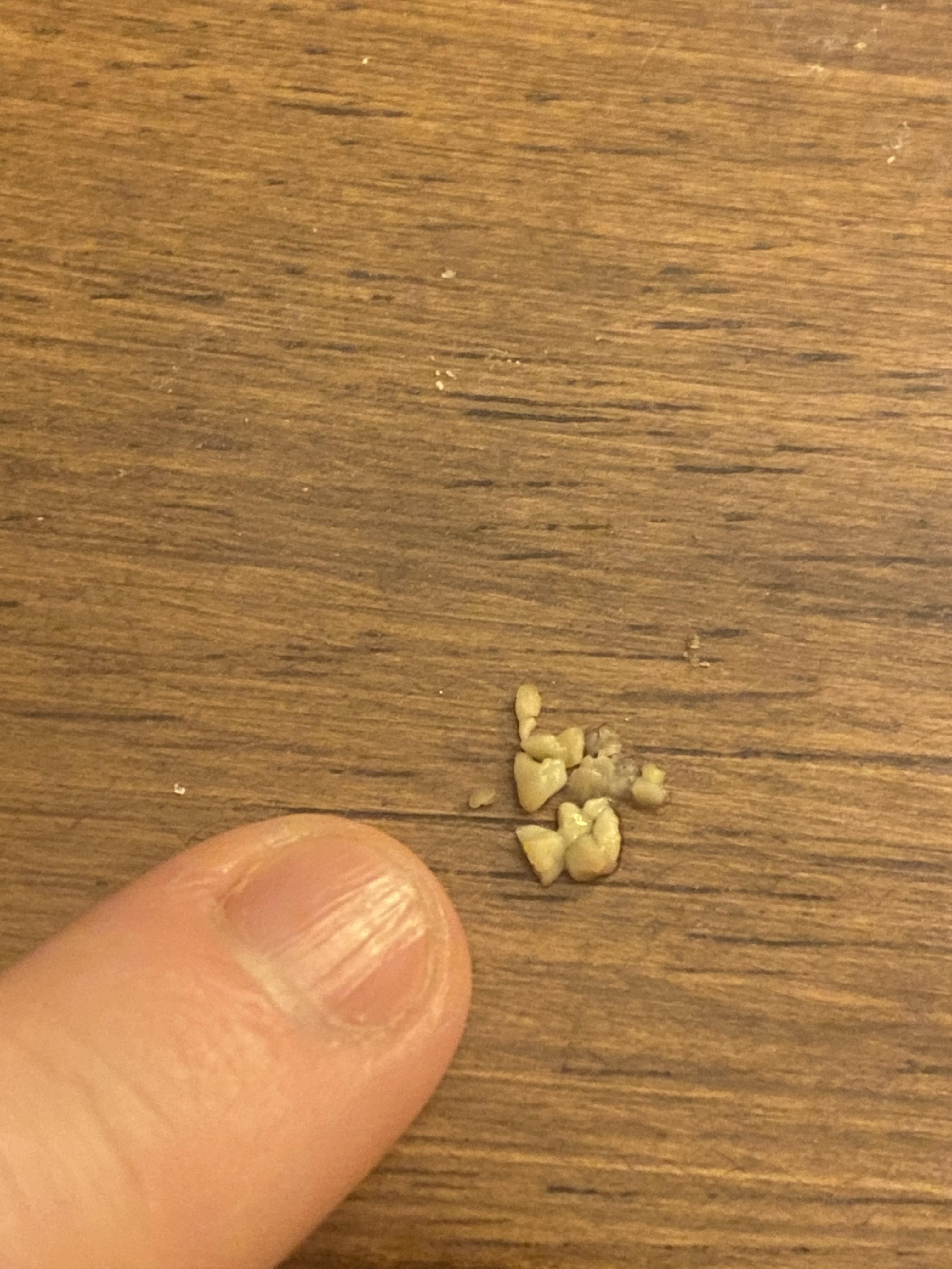 First time removing tonsil stones and gagged twice from the smell alone