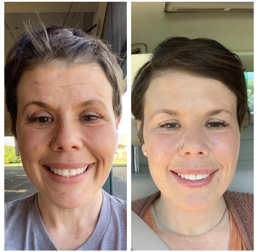 Plastic Surgery Nightmares Before and After Page 3 Survivor Sucks