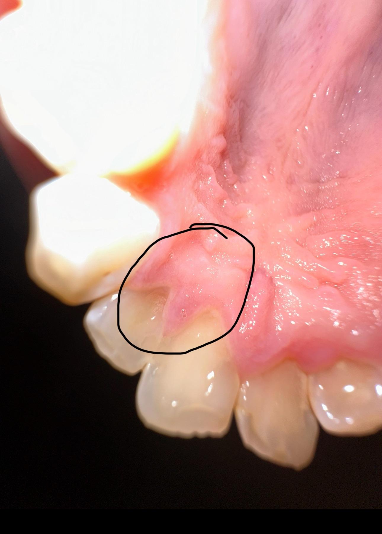 Does this look like an abscess? r/askdentists
