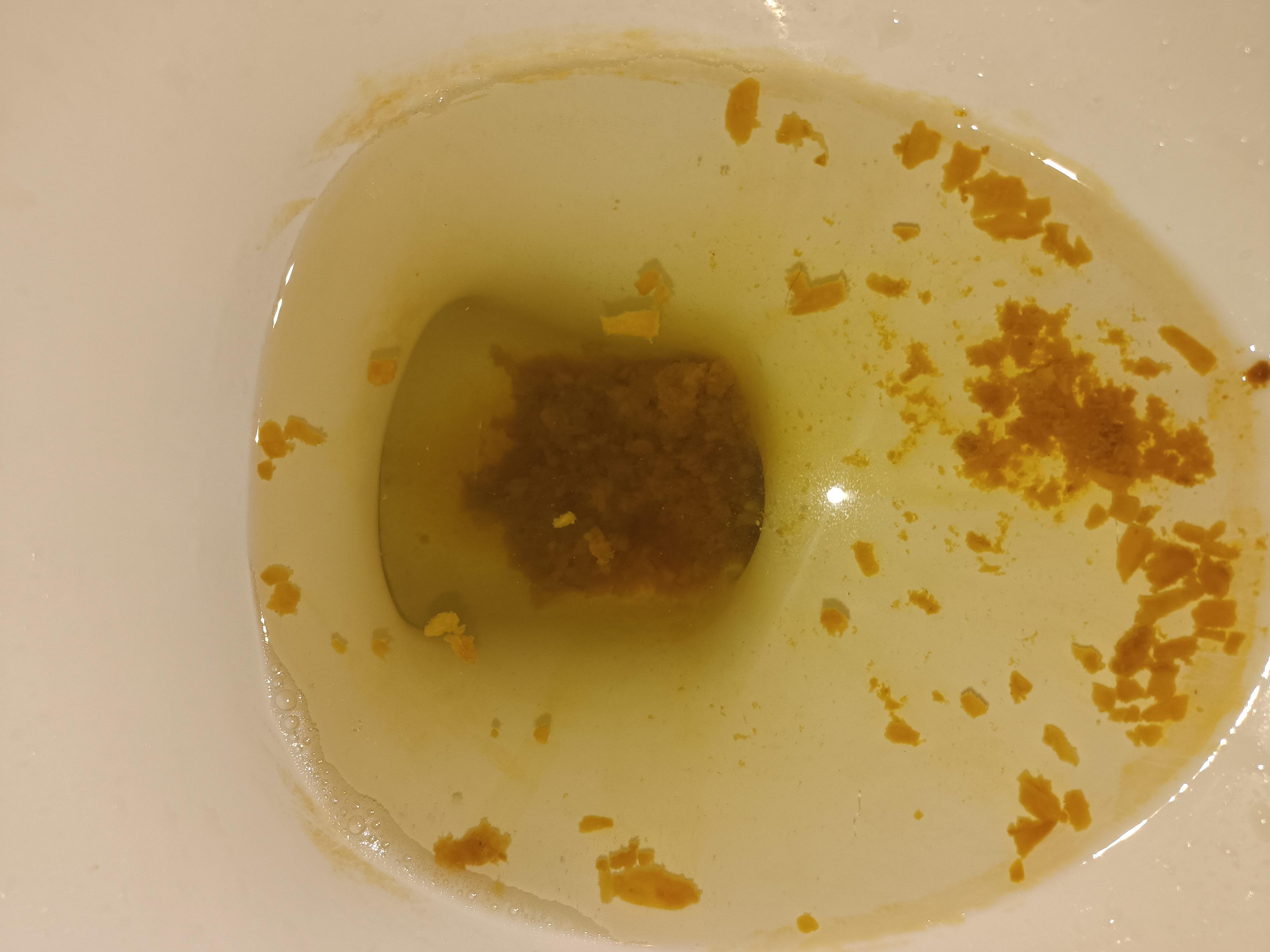 Should I be concerned? r/poop