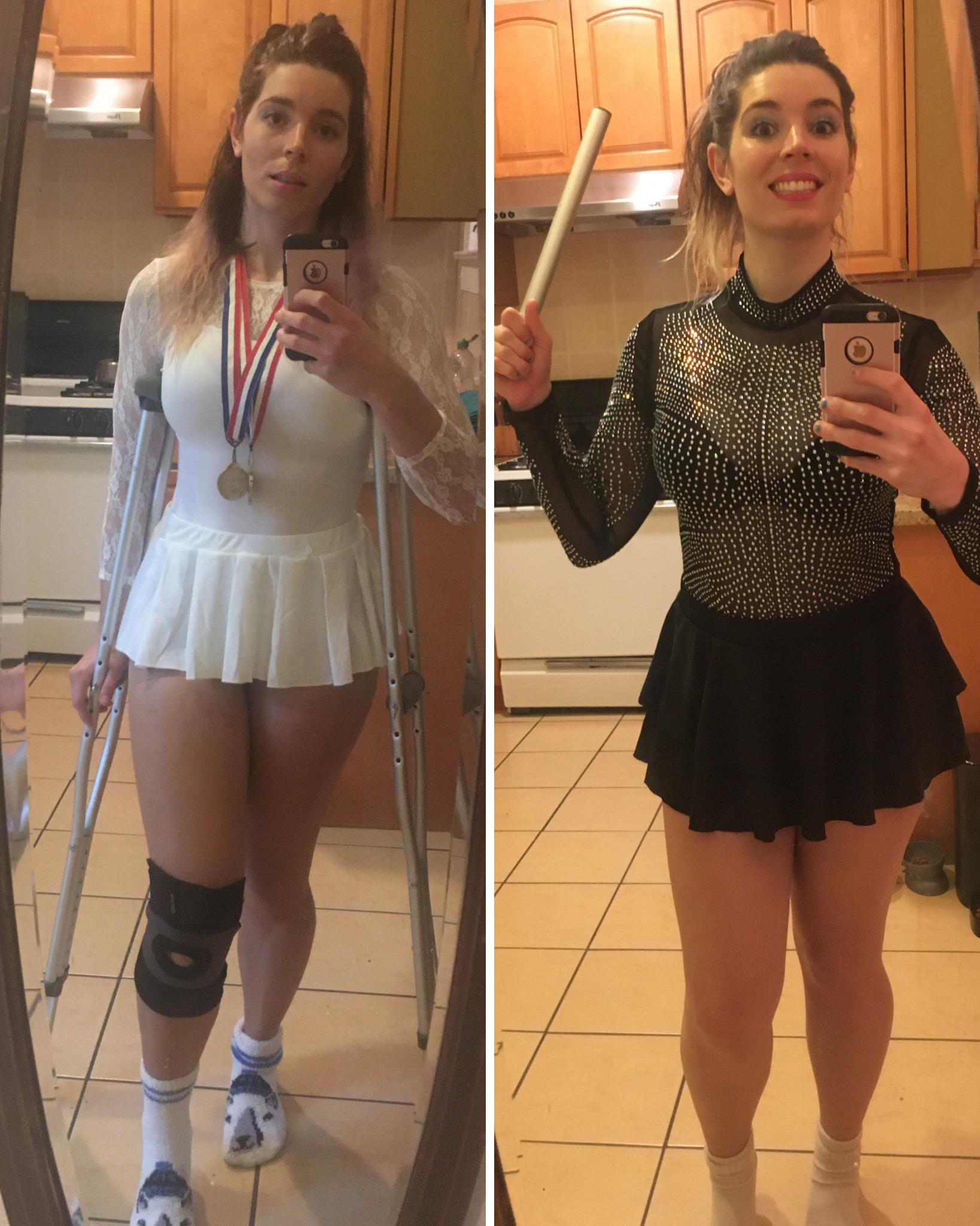 Was on Crutches Last Halloween & Went as Nancy Kerrigan This Year
