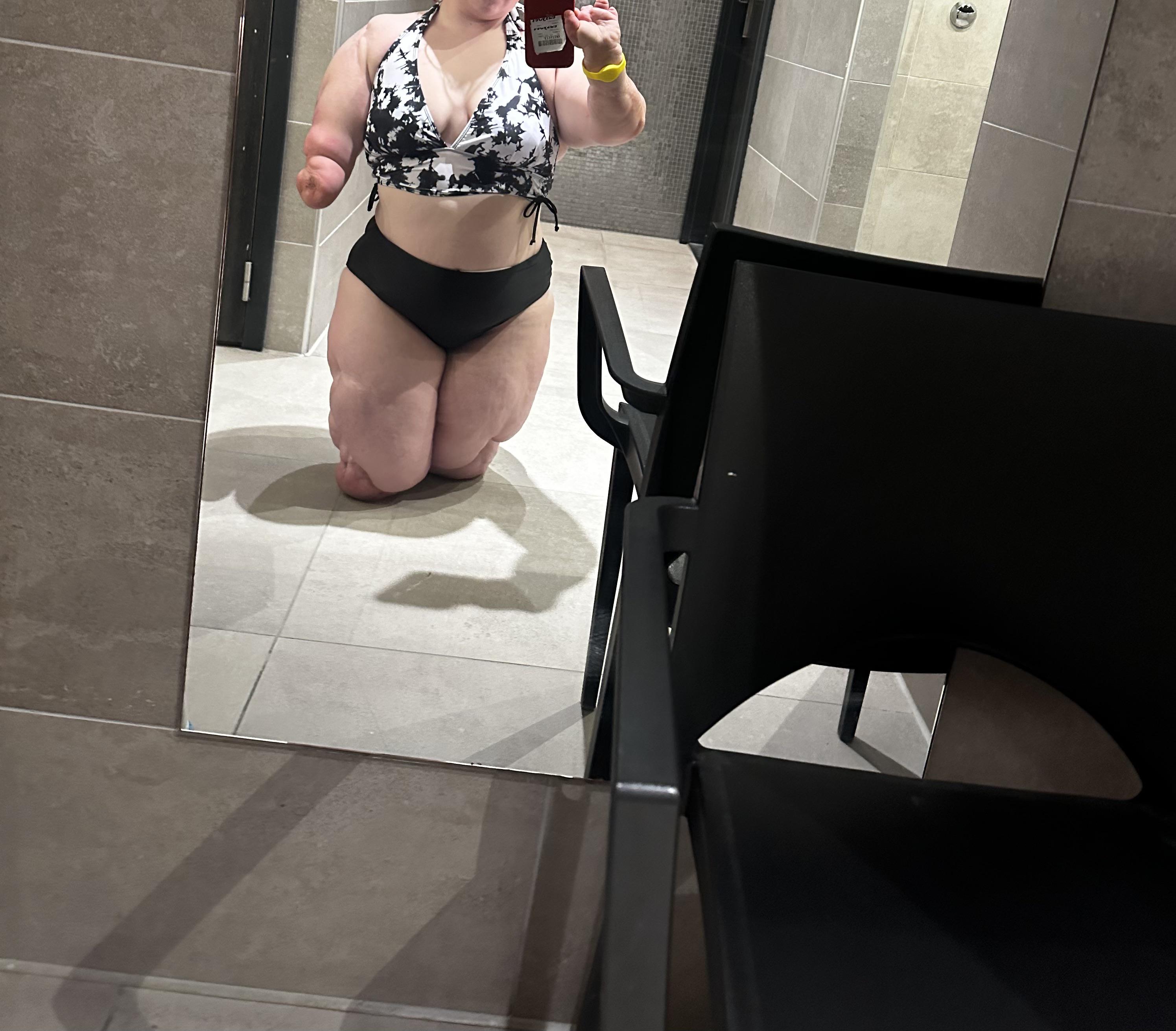 Quadruple amputee/ f/ 27 : disablednudes
