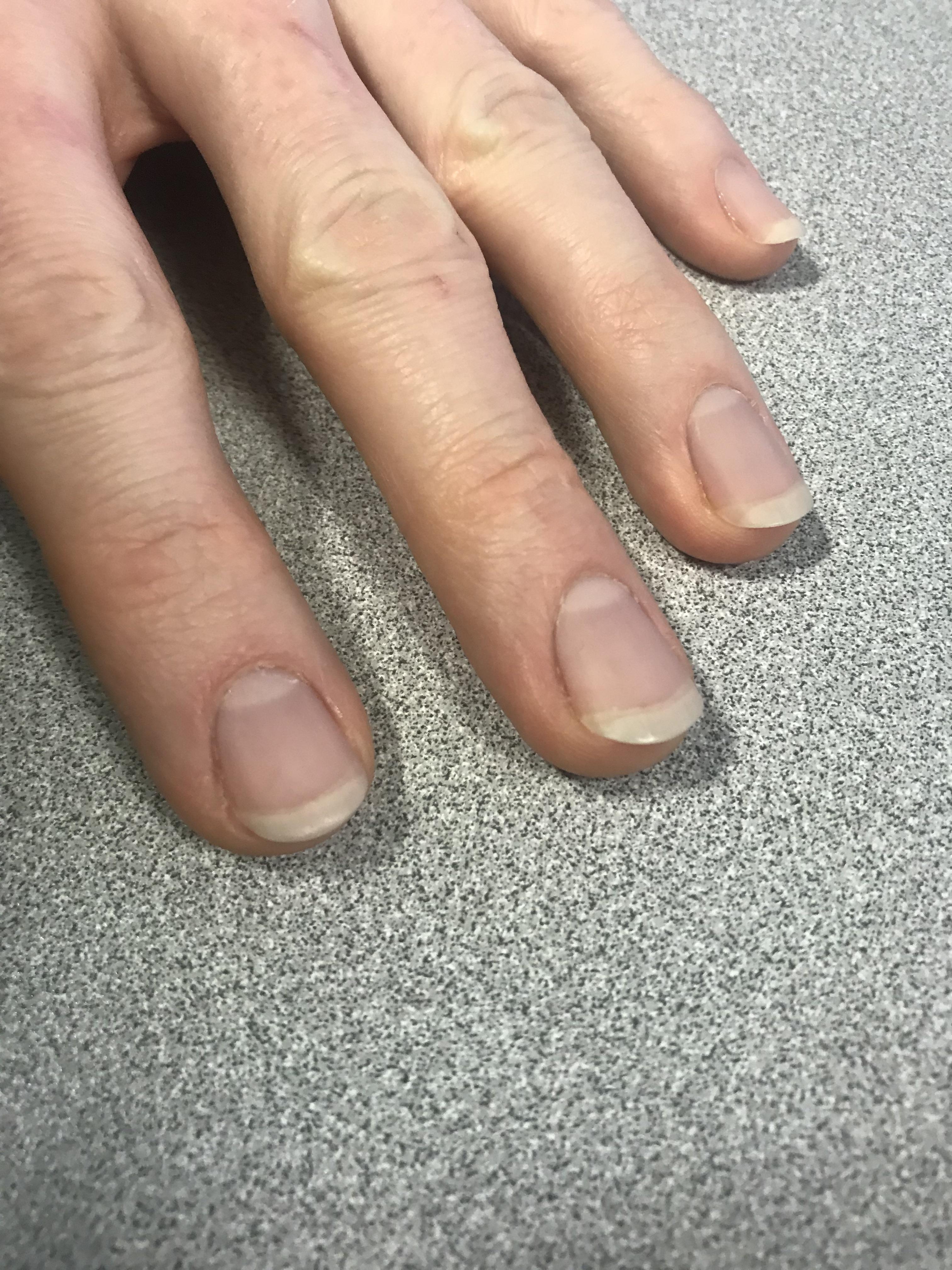 Growing out your nail beds, any advice? r/Nails