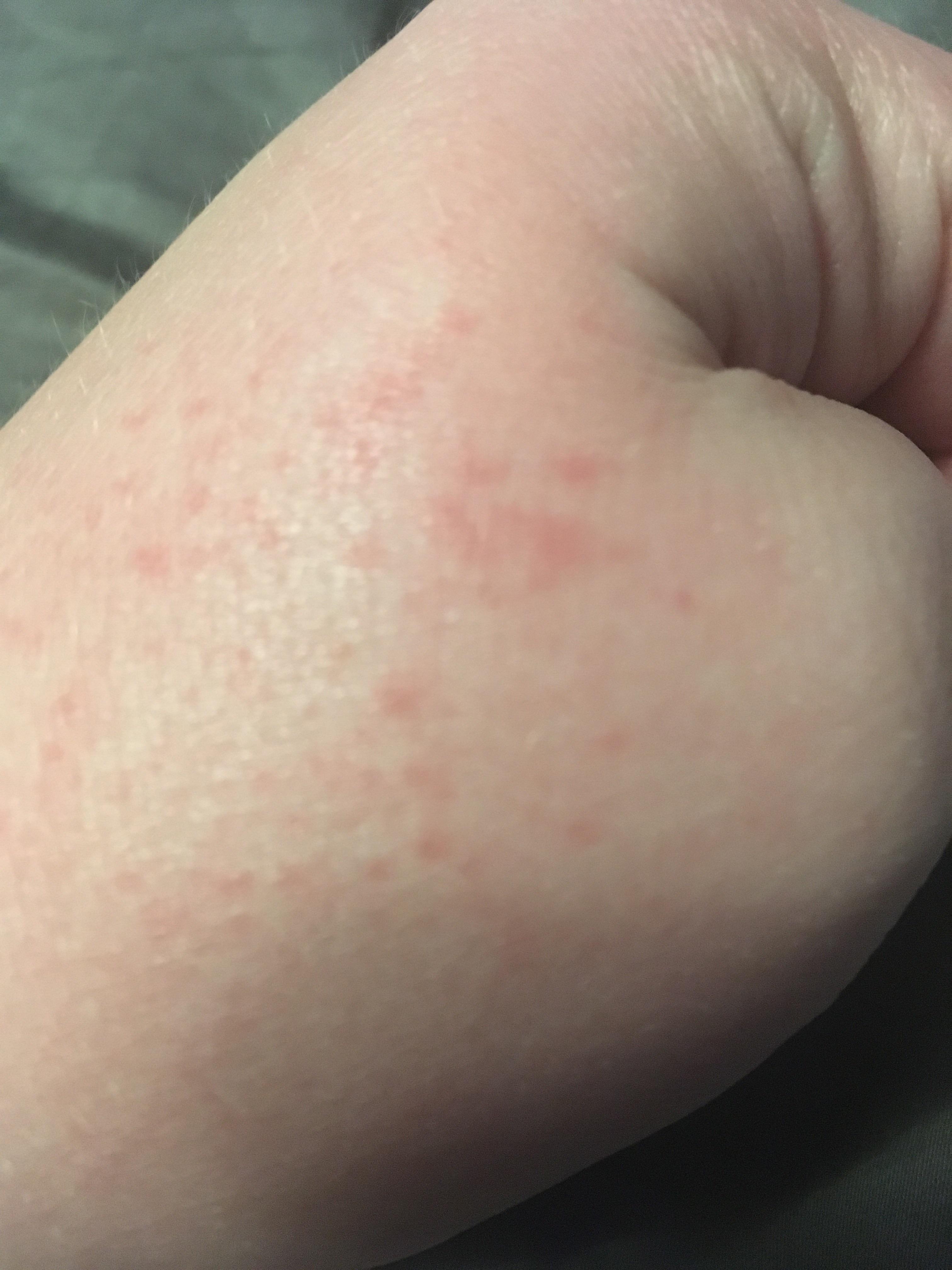 These appeared after using lube, they aren’t itchy but I’ve never seen