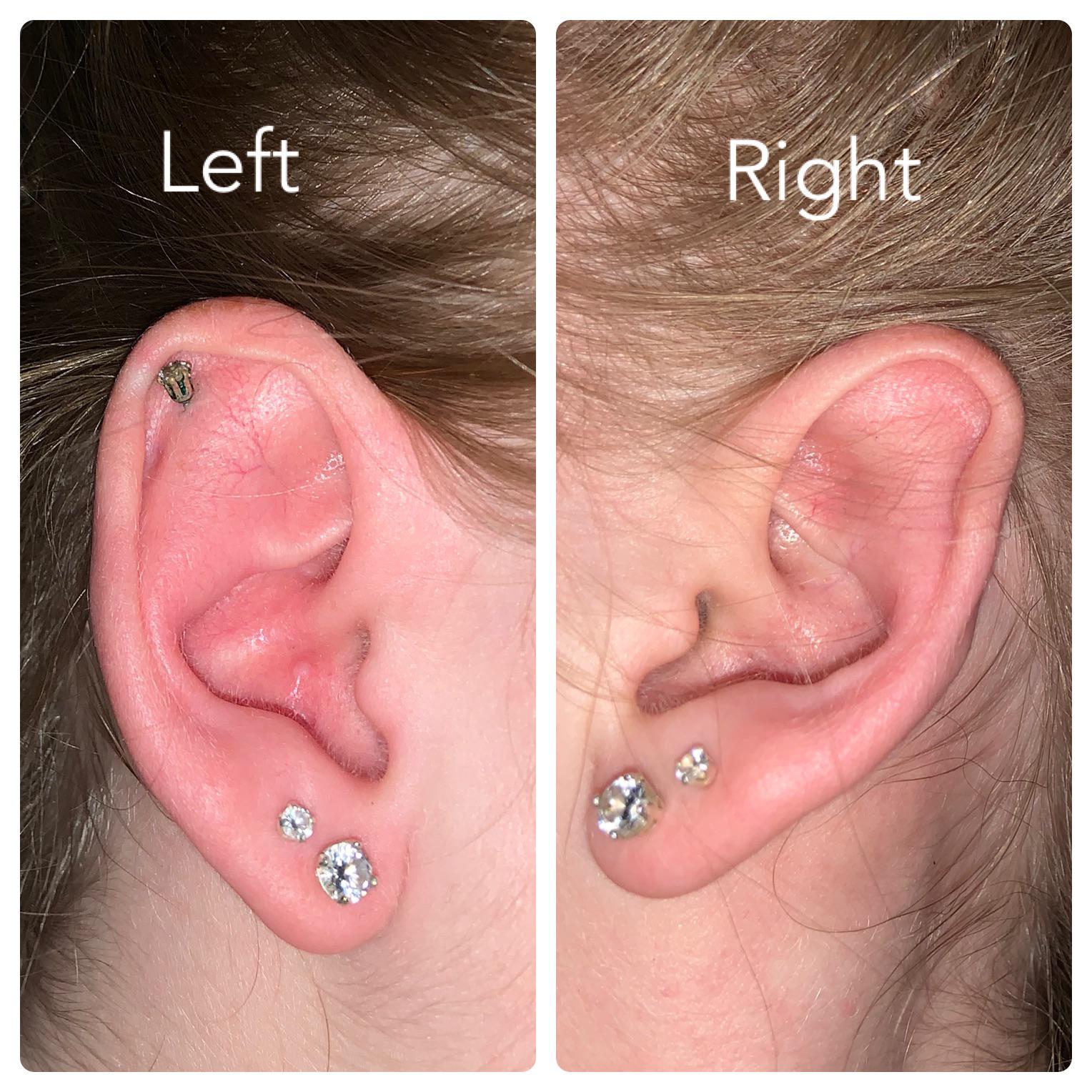 What ear piercings should i get? For reference i also have a nose