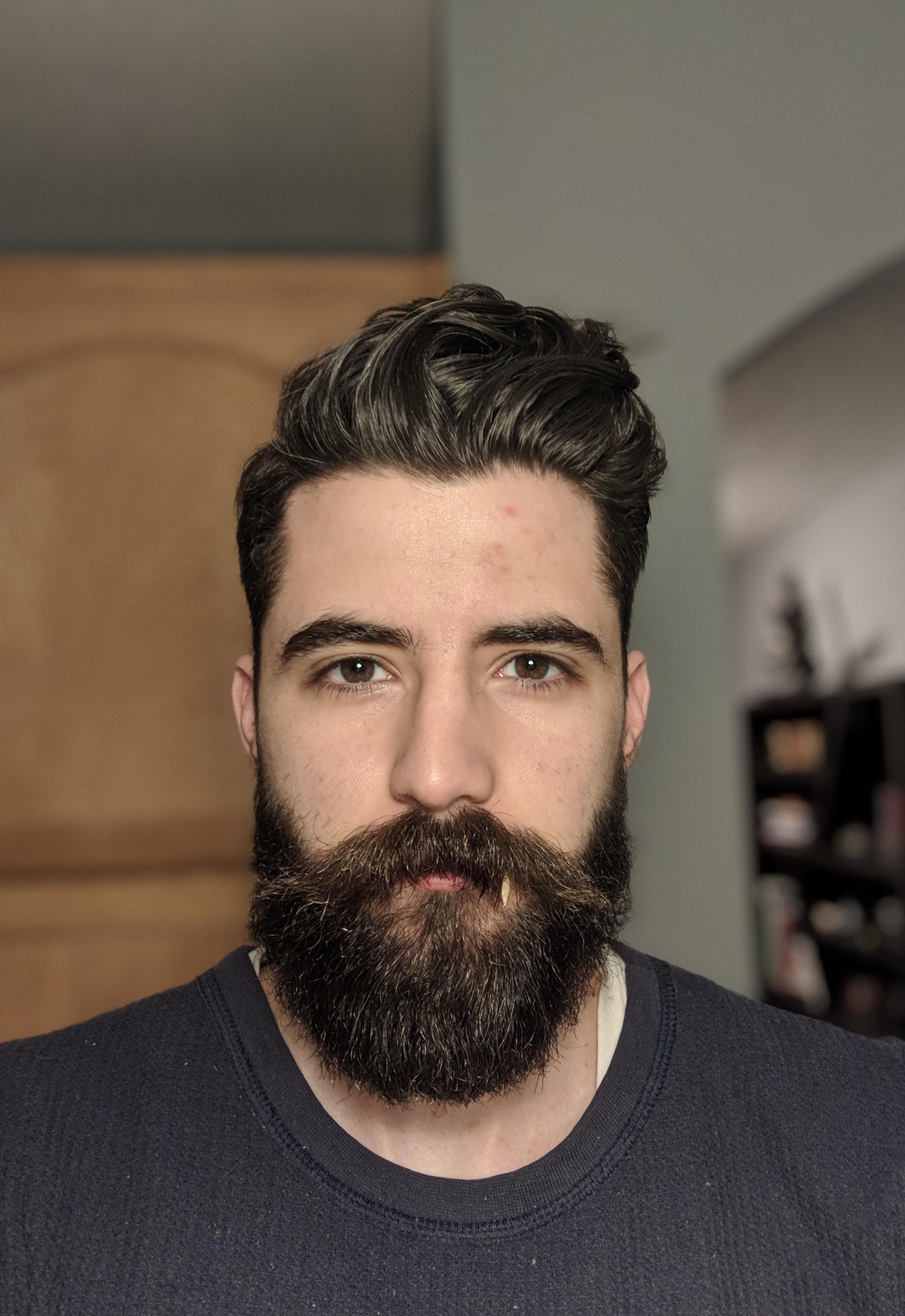 Patches still filling in even after 1 year beards