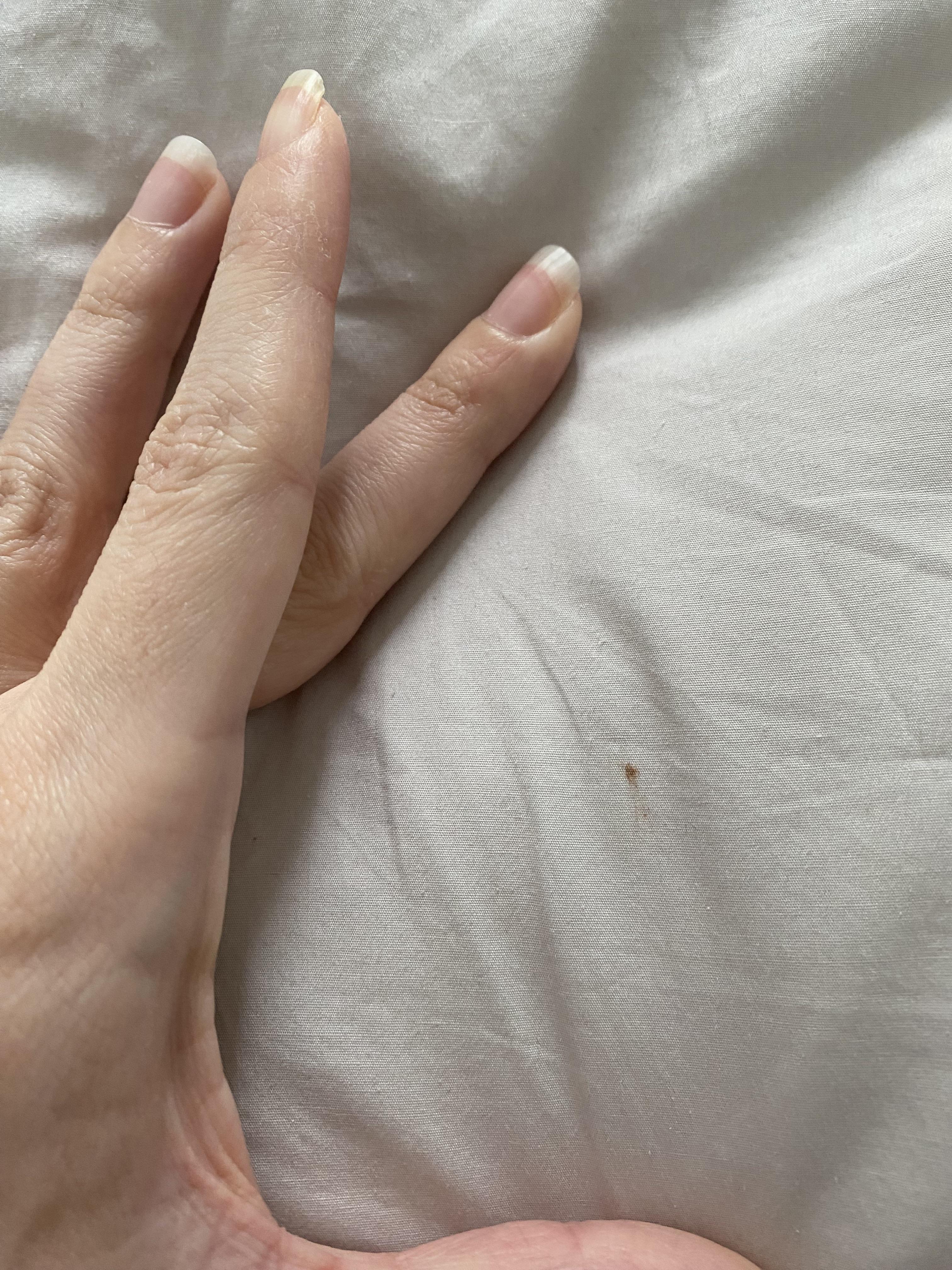 No sign of bed bugs. This isn’t a bed bug stain right? Only one on bed