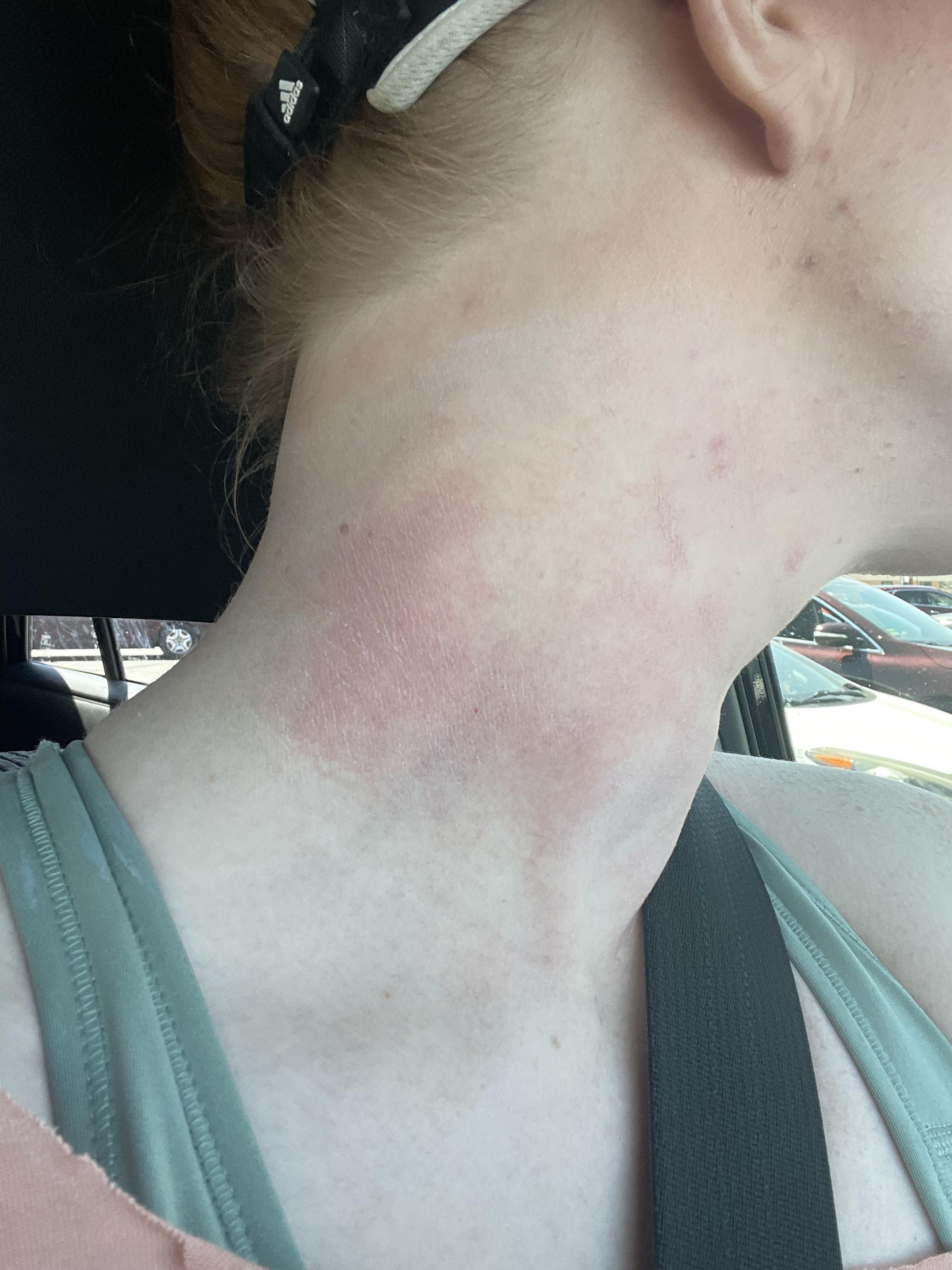 [skin concern] but also [PSA] do not buy the 10 sunscreen marked down