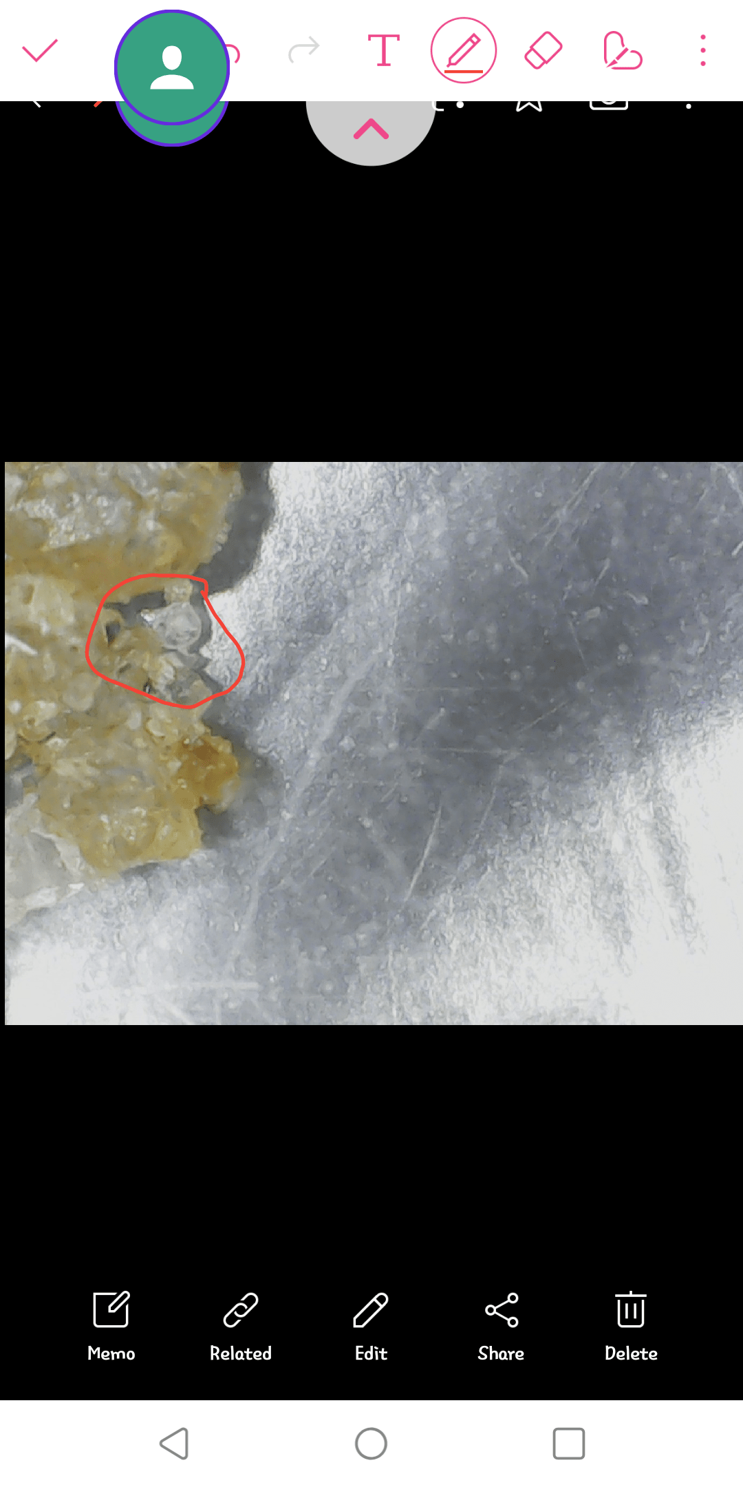 Does Scabies Die In Heat at Numbers Spires blog