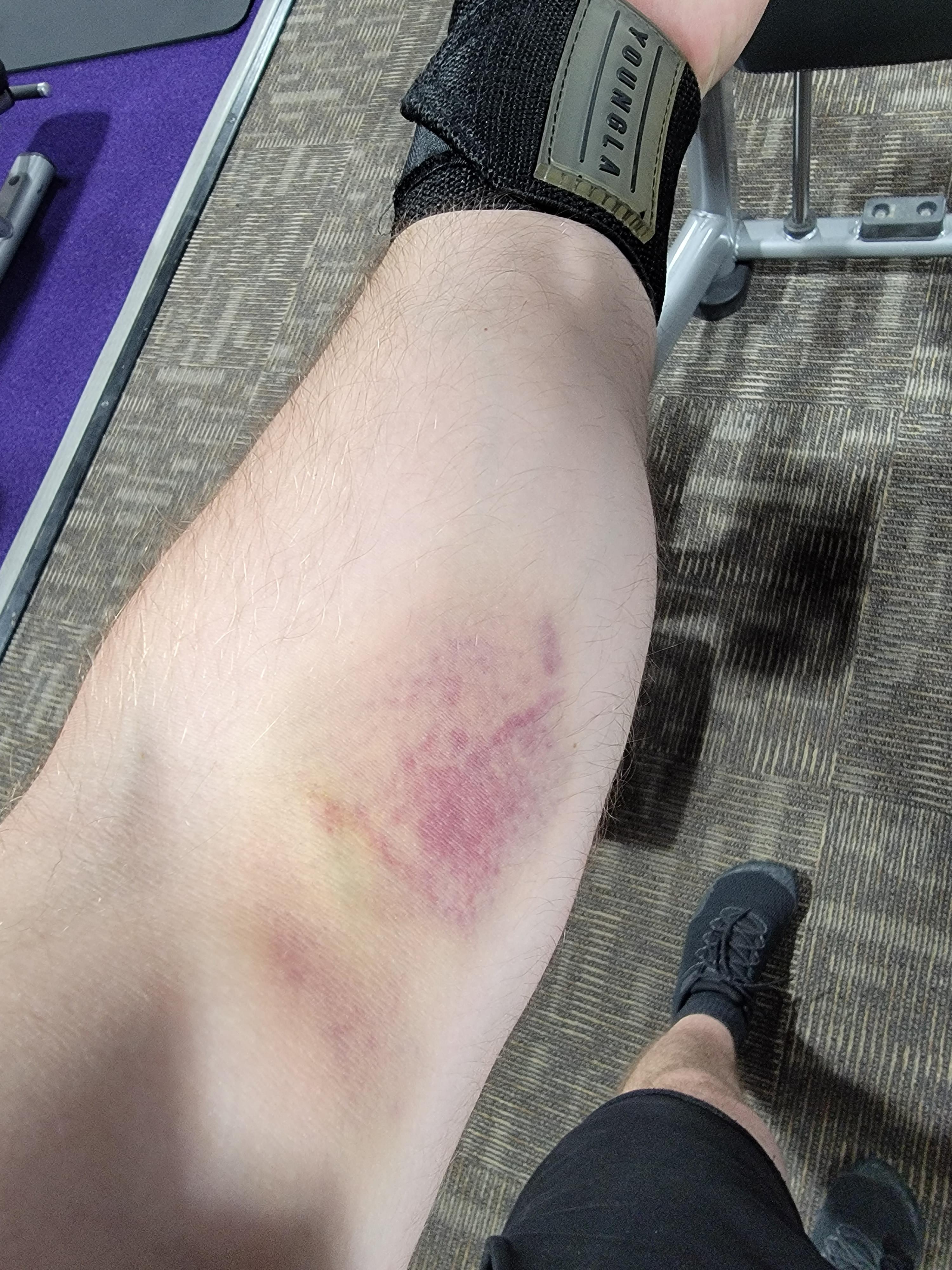 Had my blood drawn on Friday for a blood sample. Went to the gym a few