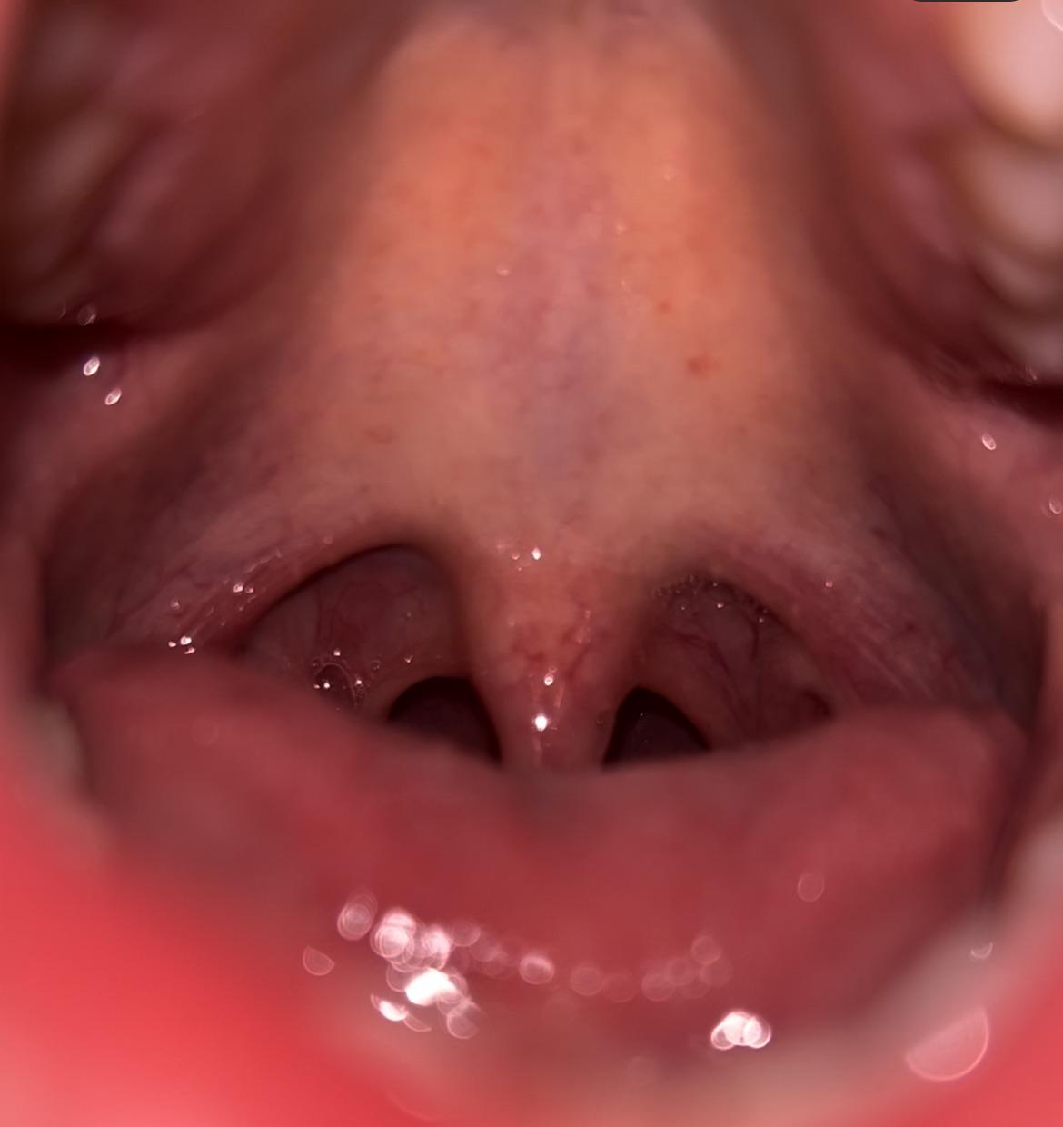 Can anyone tell me is this harmful? I've sore throat ,tonsillitis and