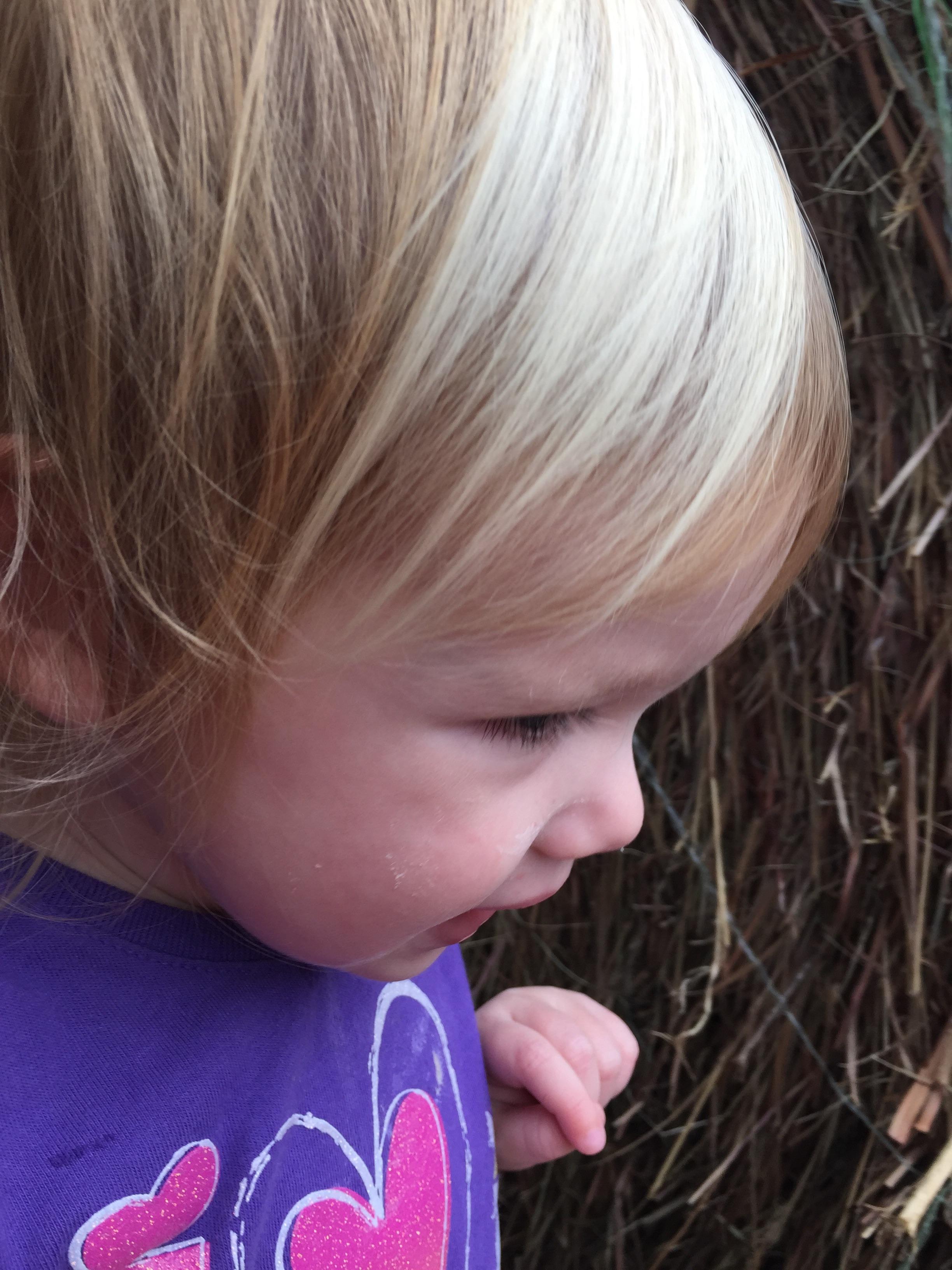 Her birthmark created awesome highlights.