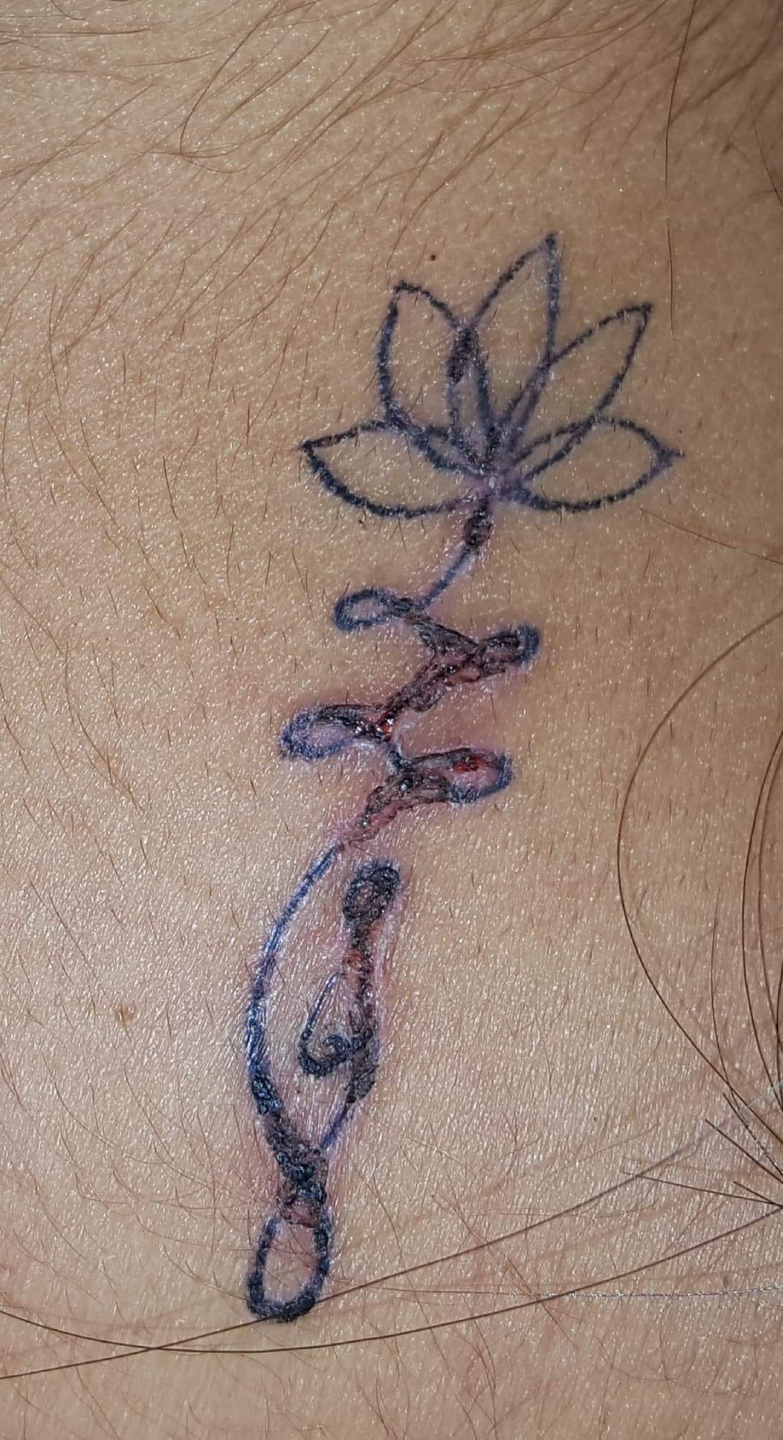 Help Is my tattoo getting infected? TattooDesigns