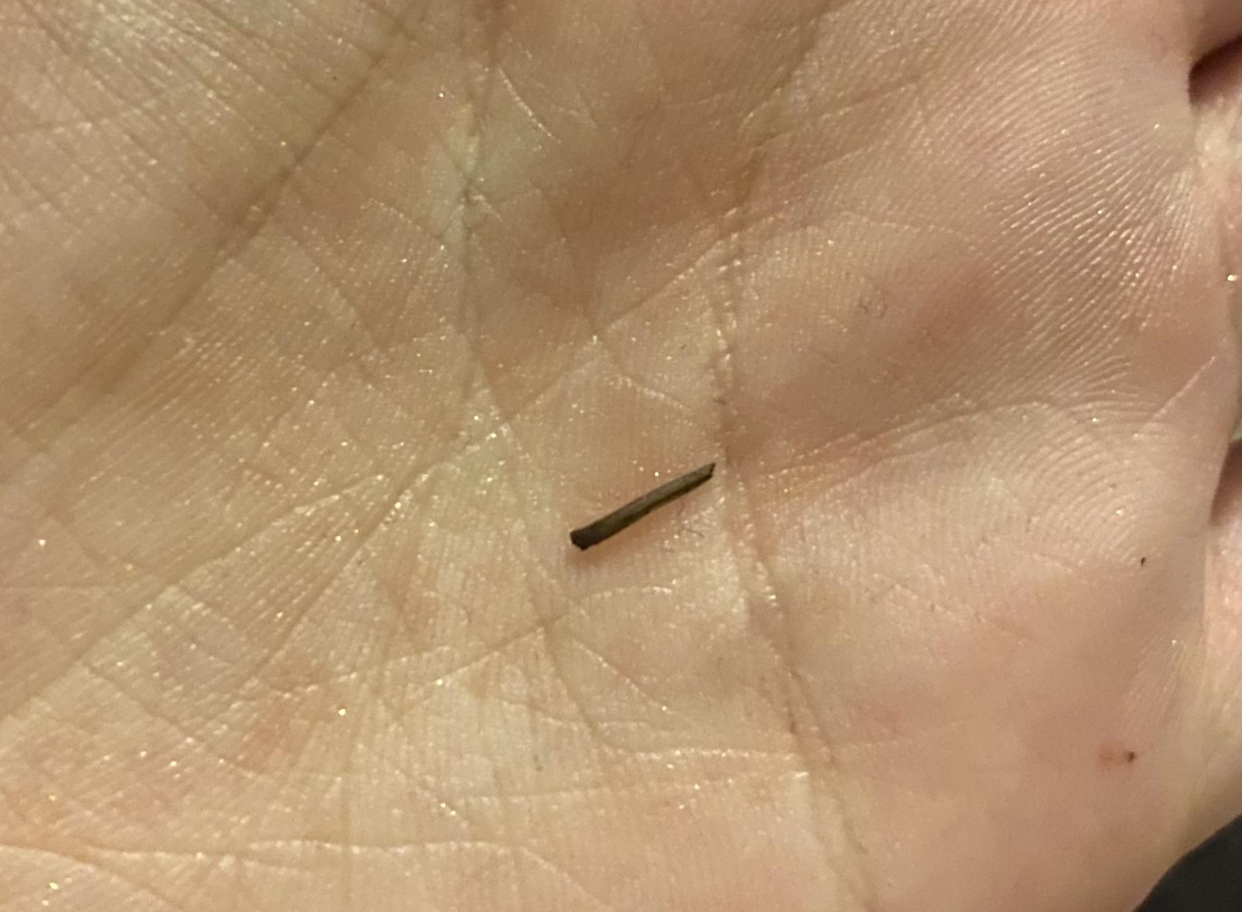 Part of my IUD string broke off???? HELP! r/CopperIUD