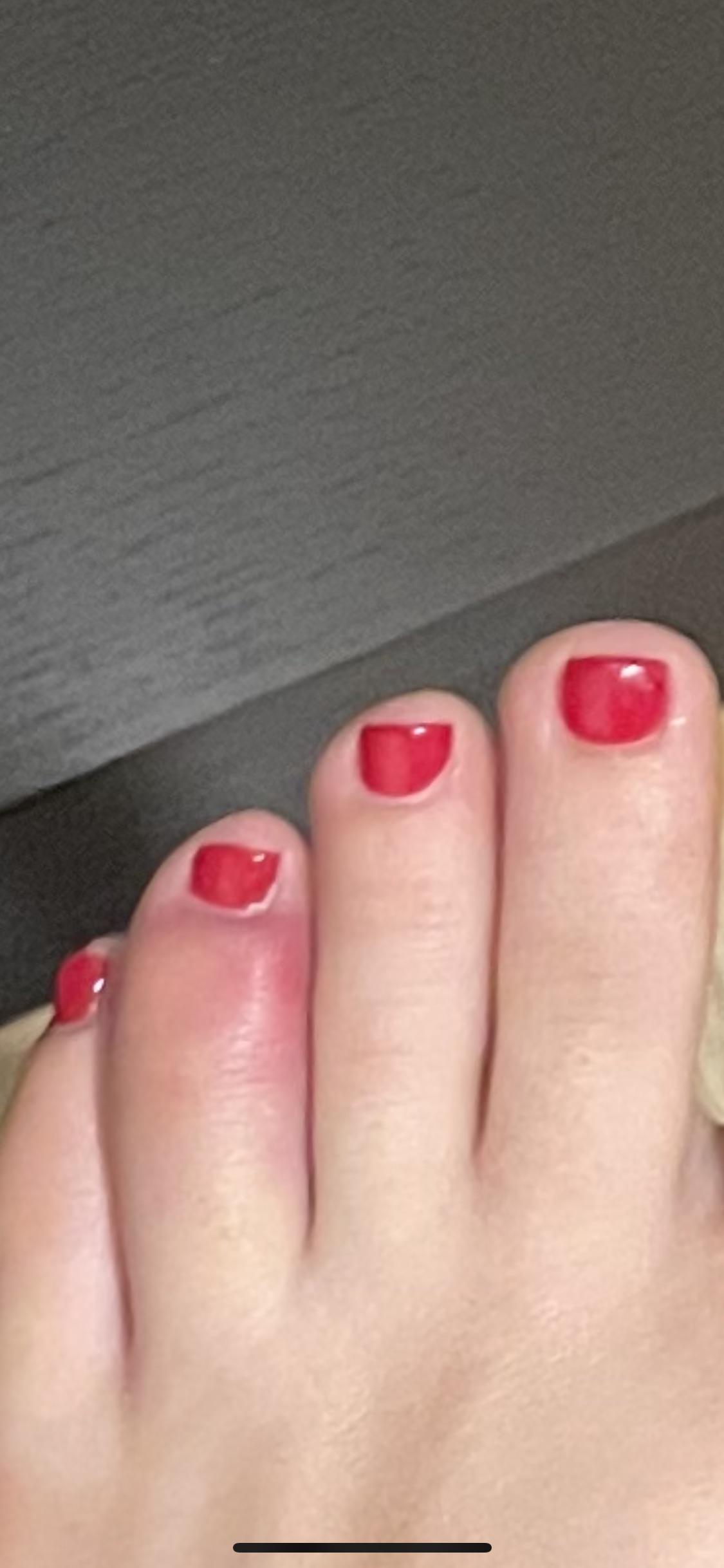 Swollen toe after pedicure r/MedicalHelp