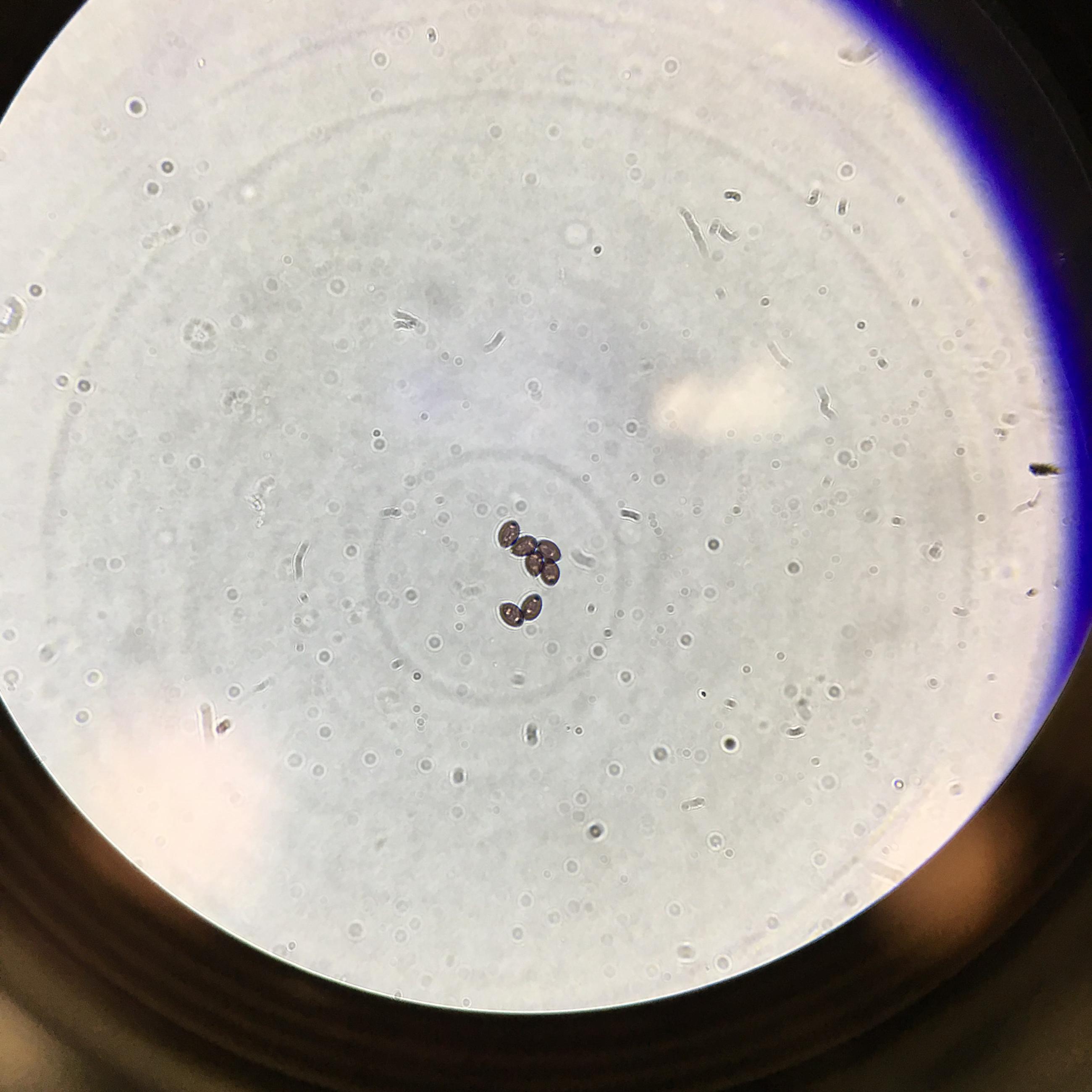 ZStrain Psilocybe Cubensis 400X magnification, hydrated spores shrooms