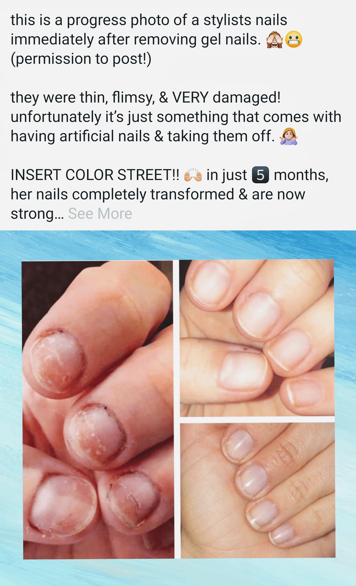 Not like nails can grow out or anything antiMLM