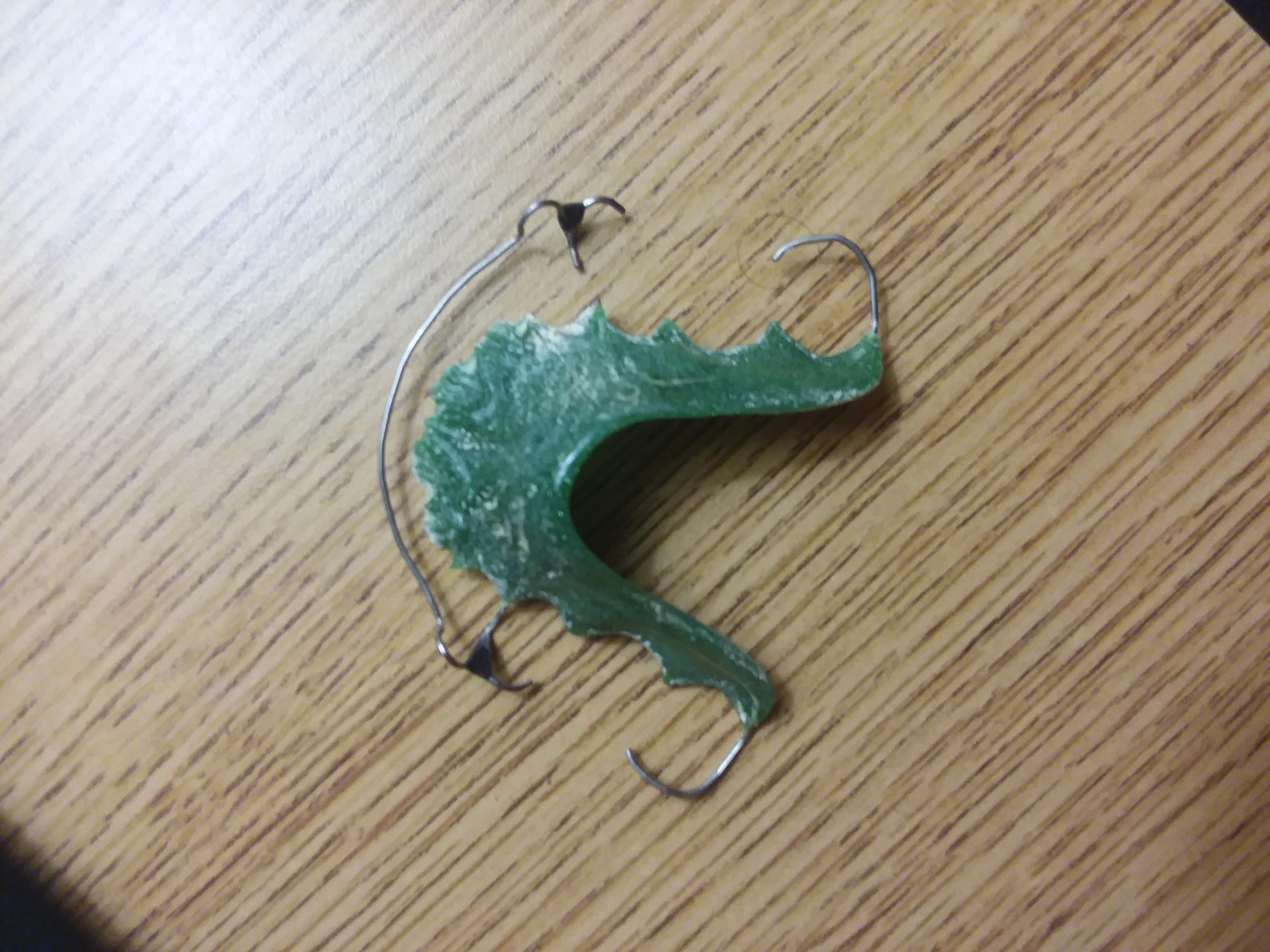 My removable retainer broke after 4 years of use. Do I need to get a