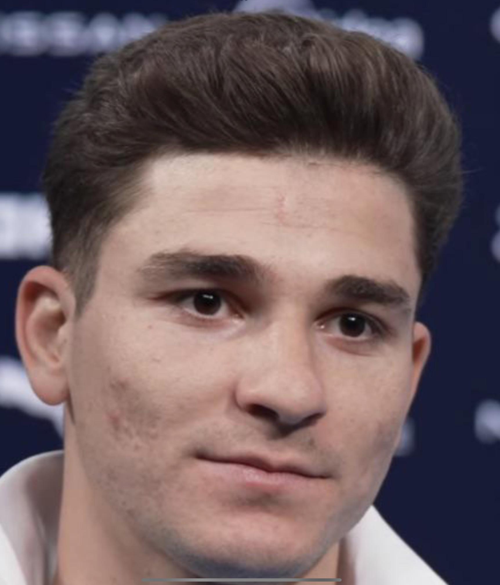 If my scalp is visible sometimes in light( more in sunlight) with this