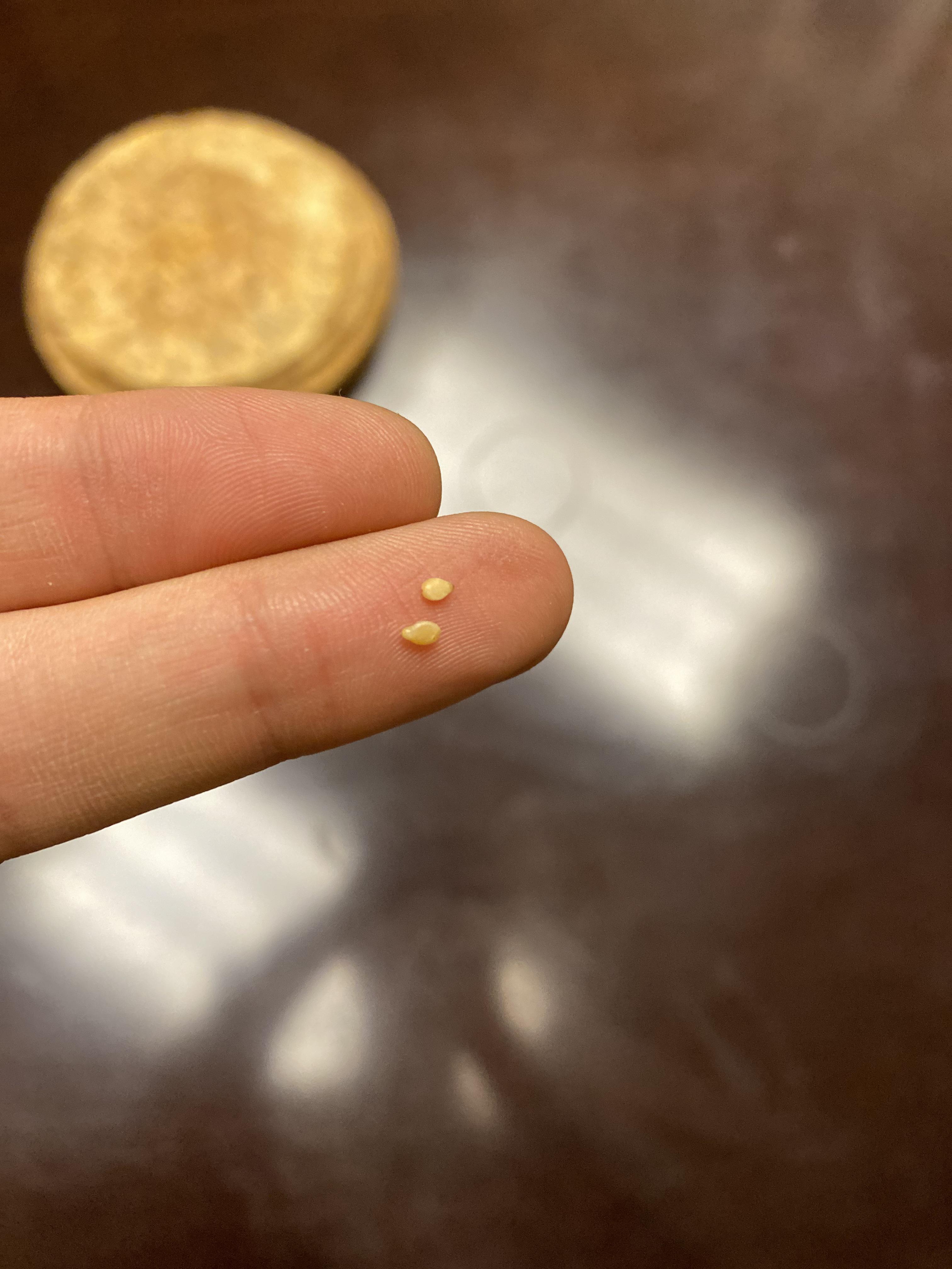 Are these bed bug eggs? They are hard & not sticky Bedbugs