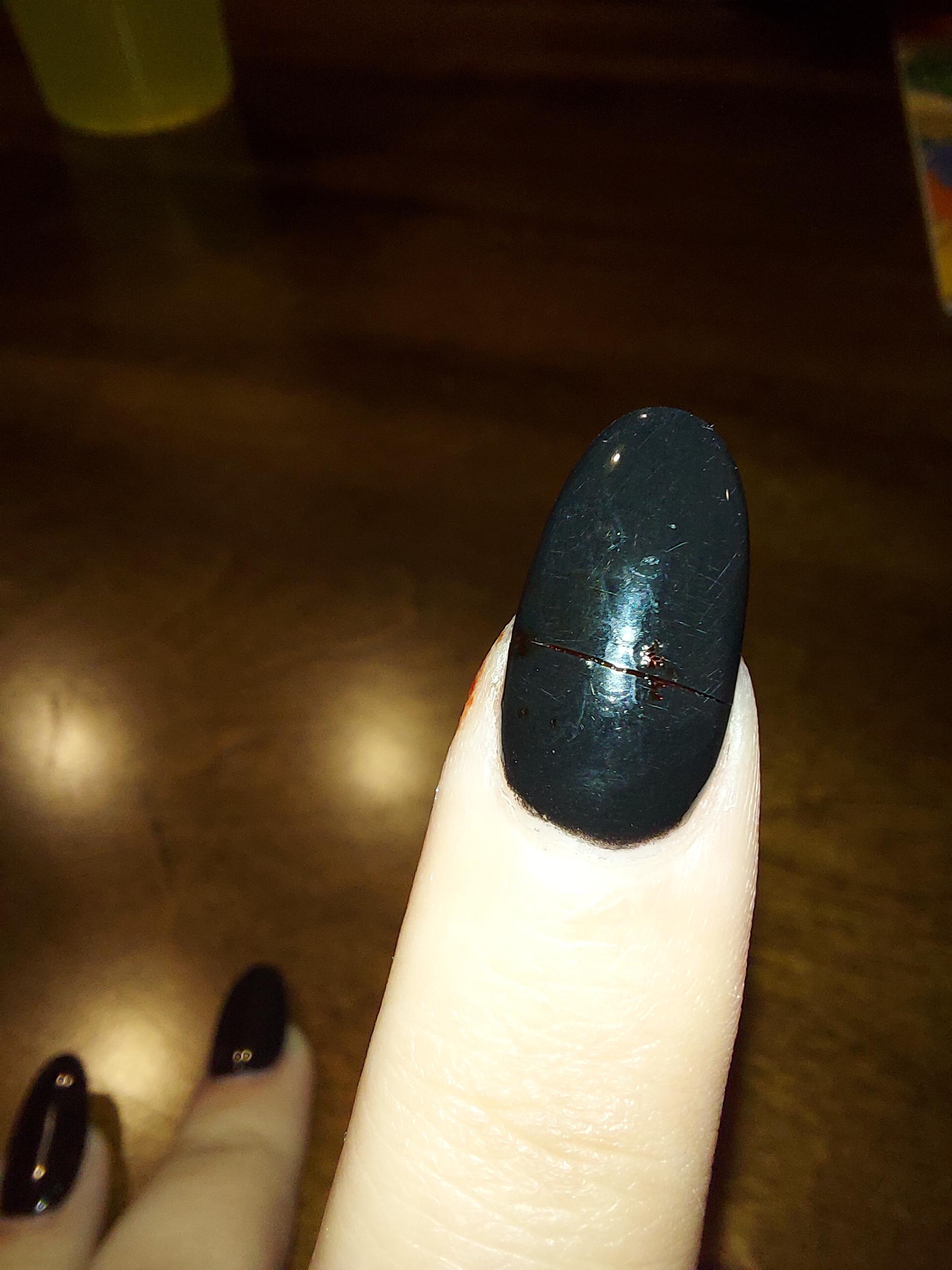 (Sorry kinda gross) Broke an acrylic nail in half a few minutes ago
