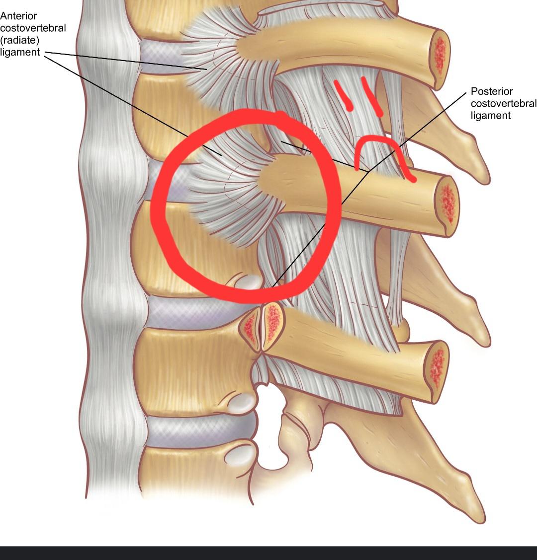 HELP INFLAMMED RIB JOINT r/golftips