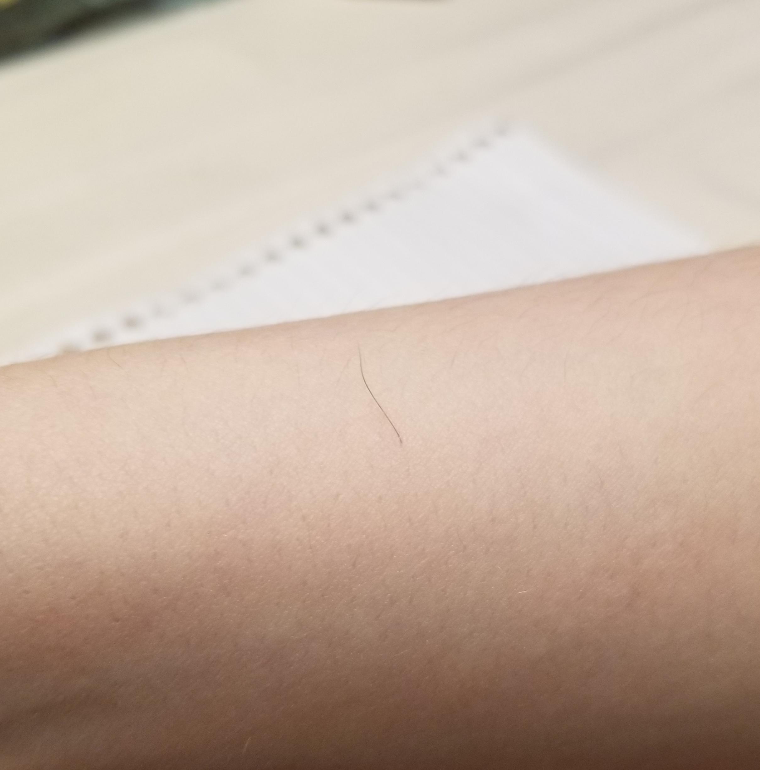 One of my arm hairs is longer and darker than the rest r